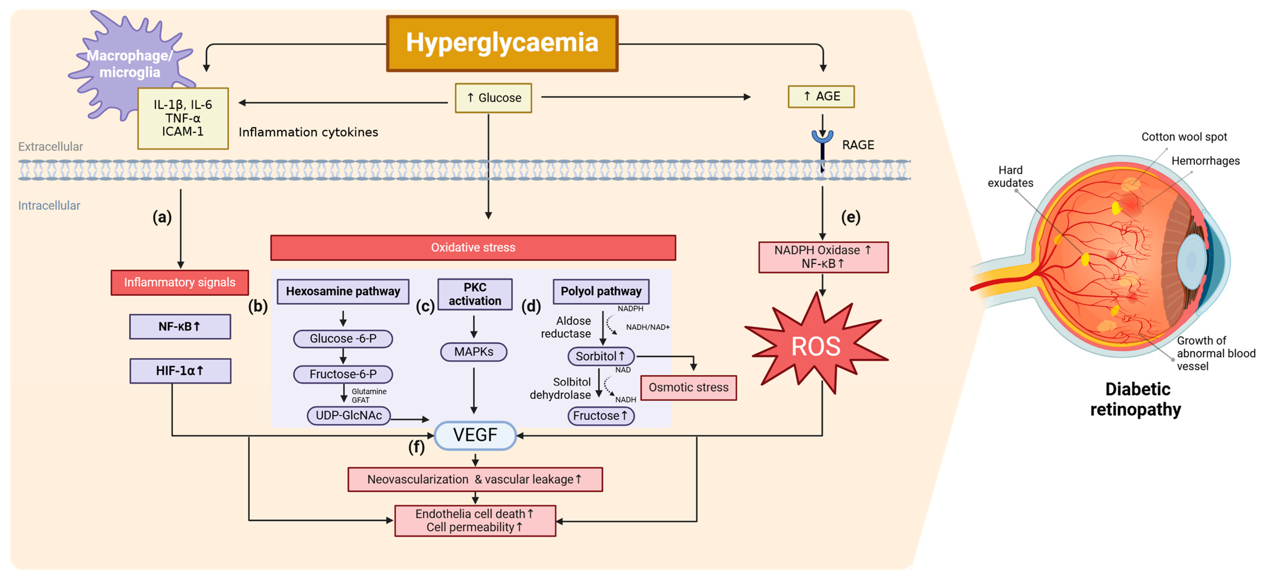 Diabetic Retinopathy (DR): Mechanisms, Current Therapies, and Emerging ...