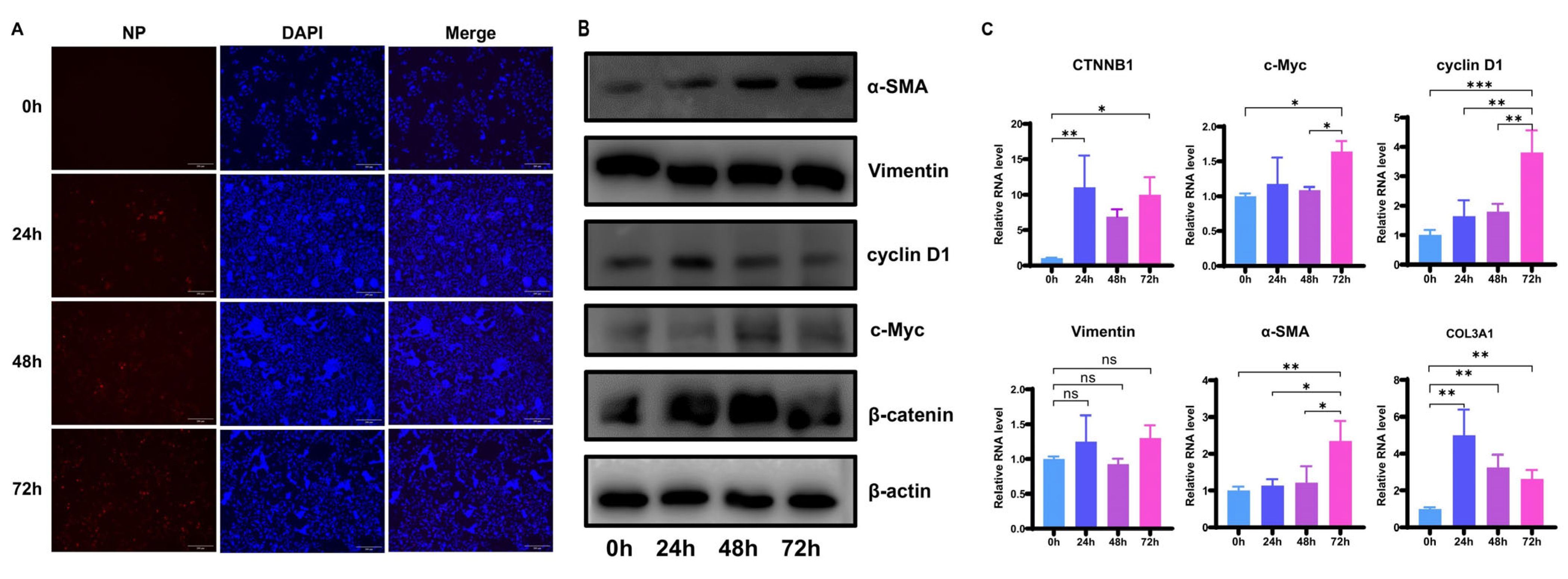 Mechanism of β-Catenin in Pulmonary Fibrosis Following SARS-CoV-2 Infection