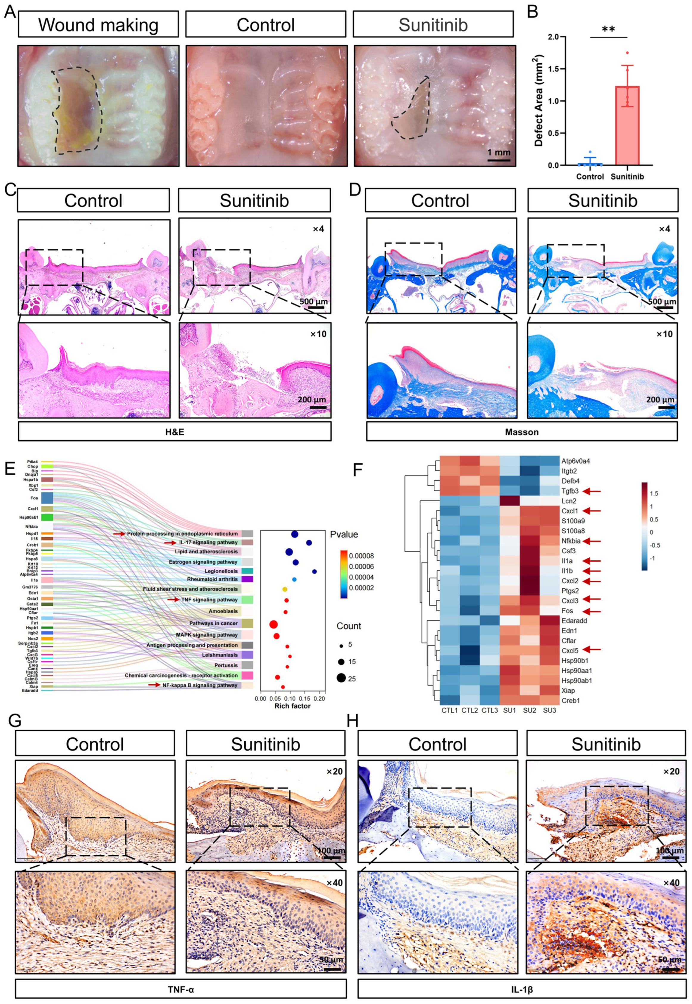 Sunitinib Impairs Oral Mucosal Healing Through Endoplasmic Reticulum ...