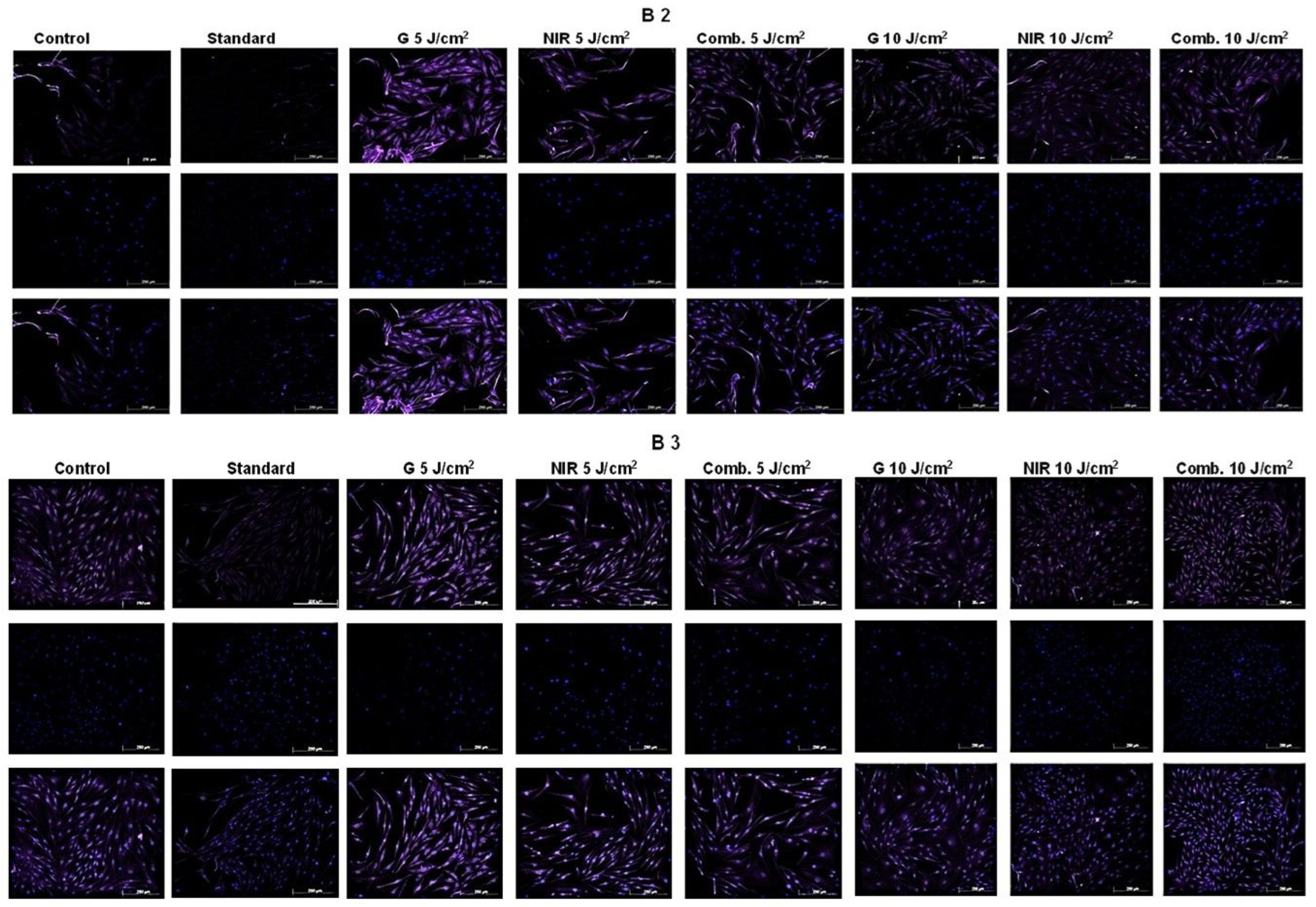 Photogenic Muscle Optimizing Photobiomodulation for Smooth Muscle Differentiation of ...