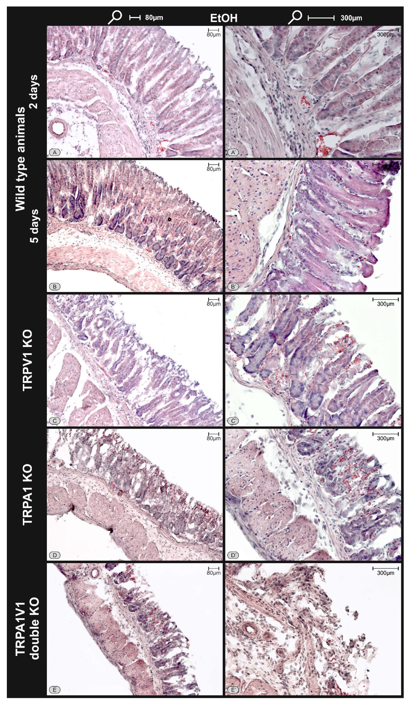 TRPA1 and TRPV1 Receptors Protect the Gastric Mucosa from Ethanol ...