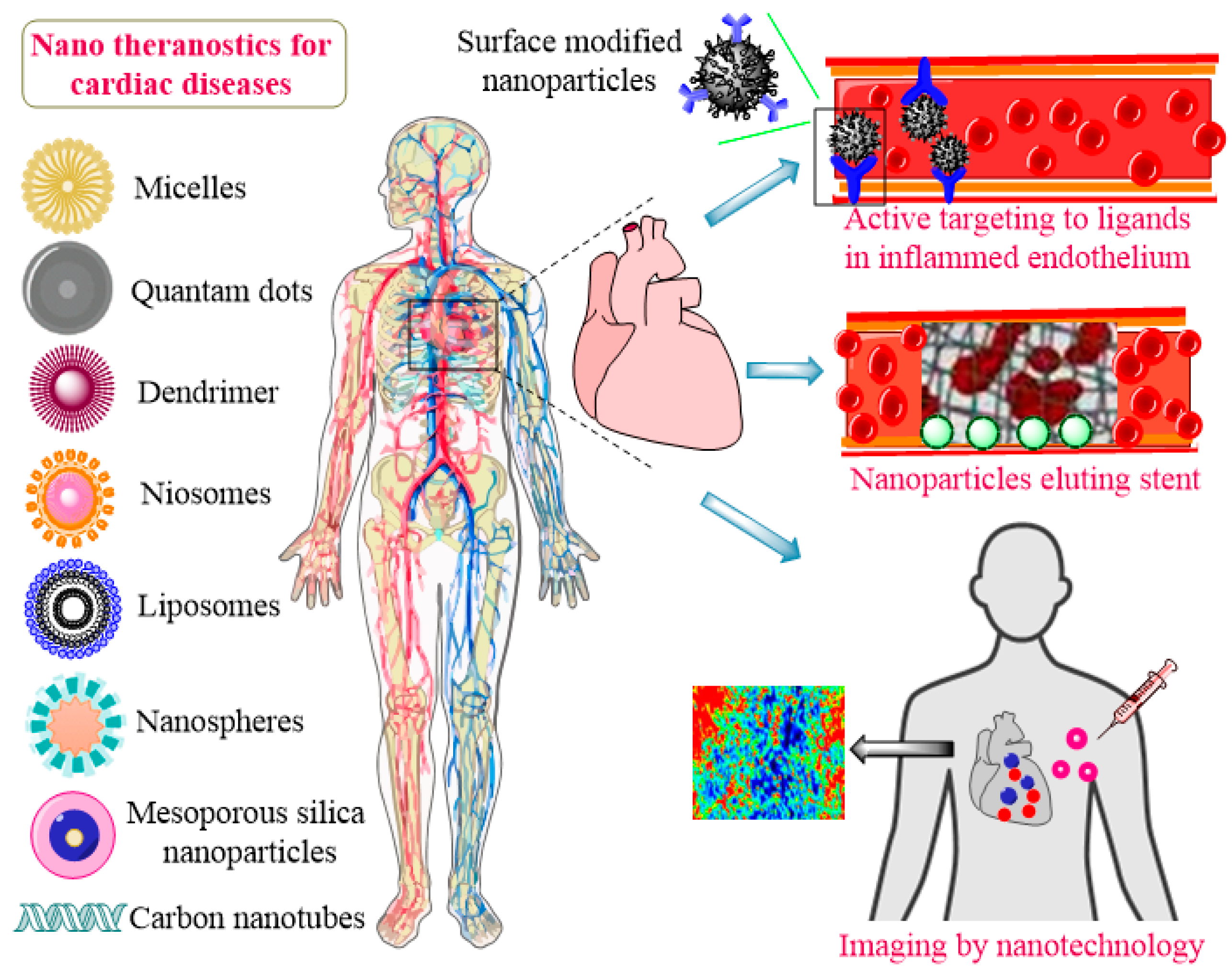 Chemosensors | Free Full-Text | Nanodiagnosis and Nanotreatment of Cardiovascular Diseases: An Overview