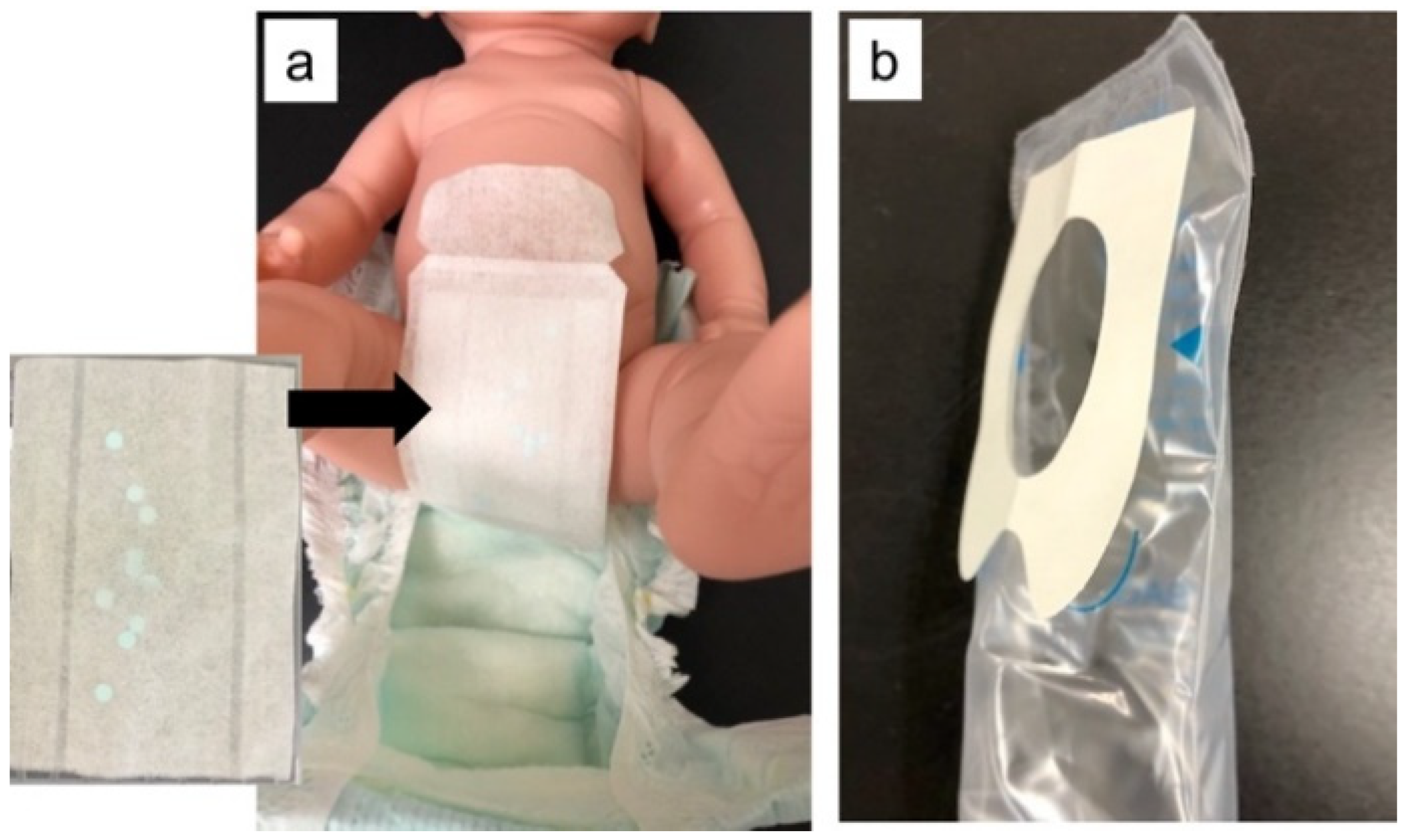 Children | Free Full-Text | Clinical Evaluation of a Novel Urine Collection  Kit Using Filter Paper in Neonates: An Observational Study
