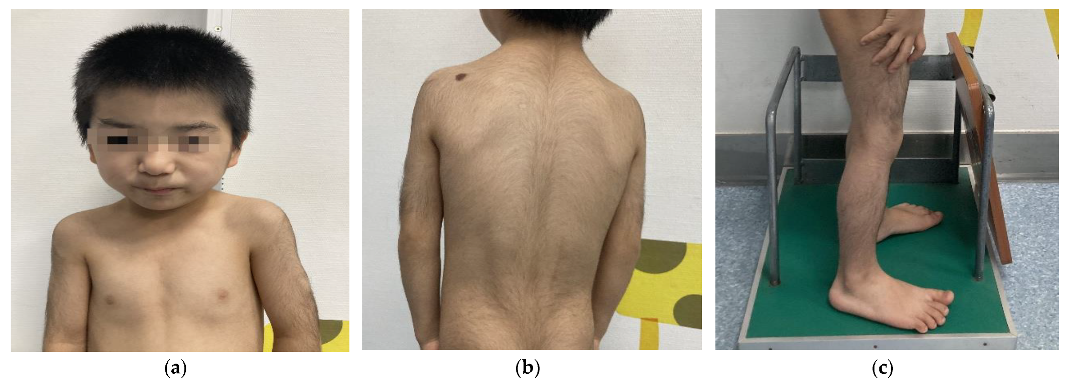 Rubinstein‐Taybi syndrome in Chinese population with four novel