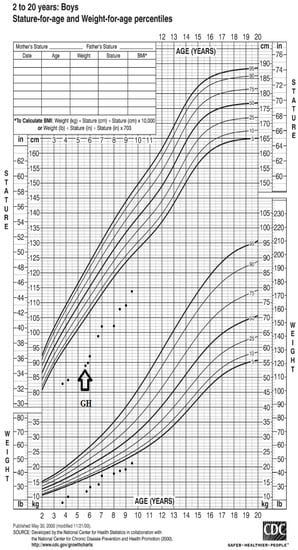 Children | Free Full-Text | Initial Effect of Recombinant Human Growth ...