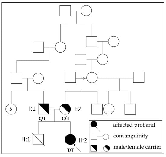 Children | Free Full-Text | An Unusual Case of Neonatal Hypotonia and ...