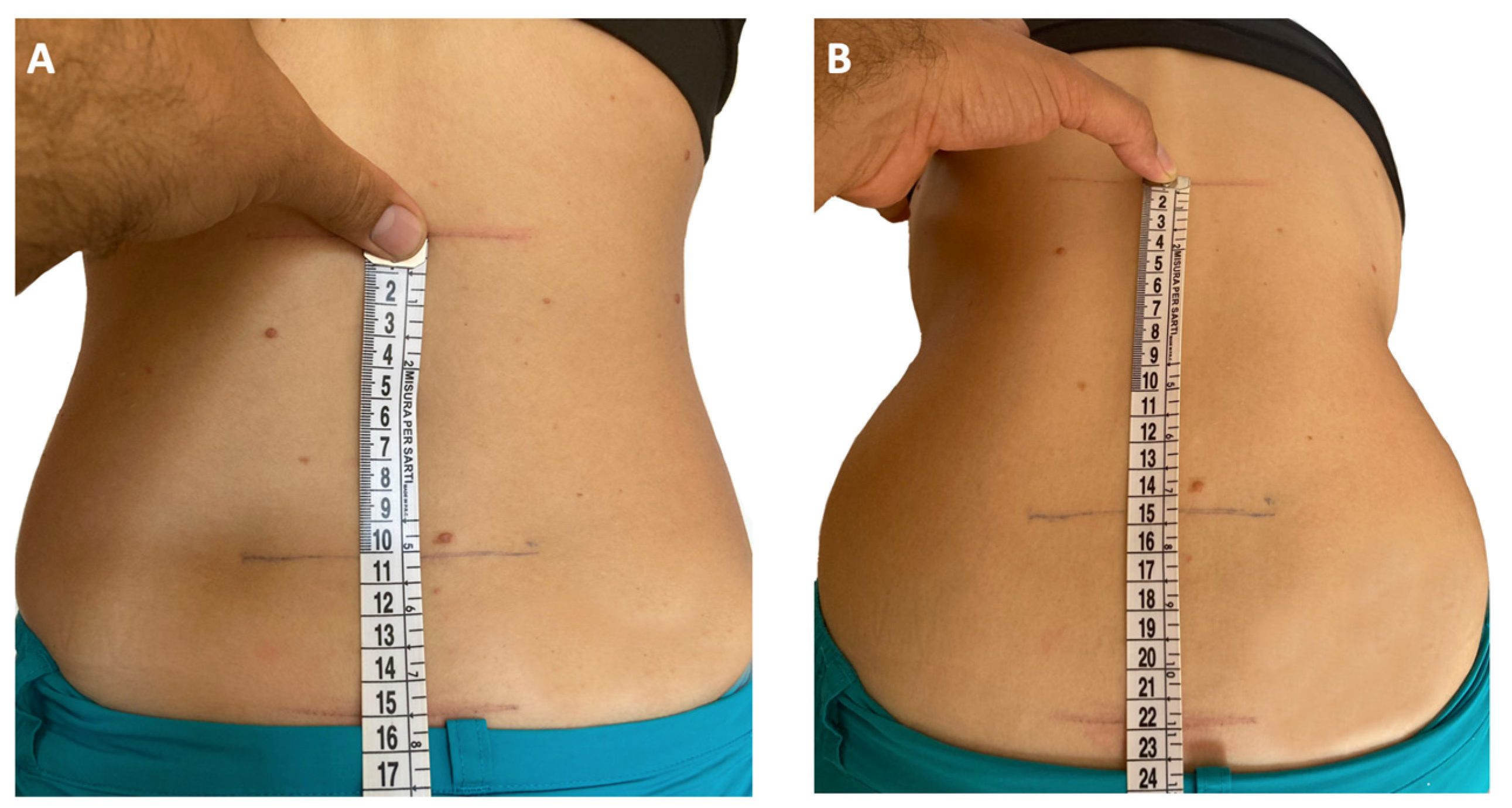 Advances In The Diagnosis And Treatment Of Enthesitis Related Arthritis