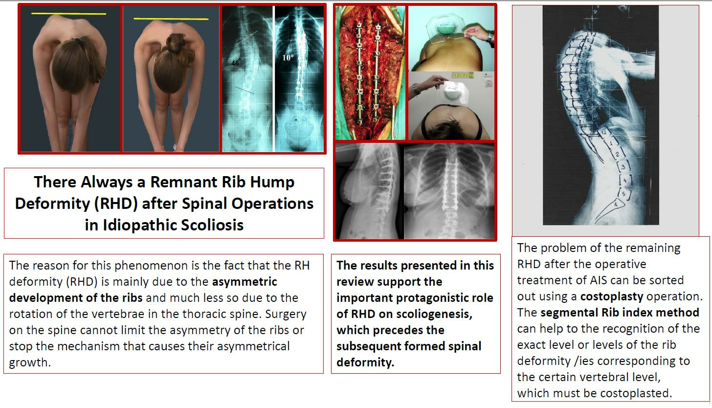 Best Practices for Establishing Vertebral Level on Thoracic Spine