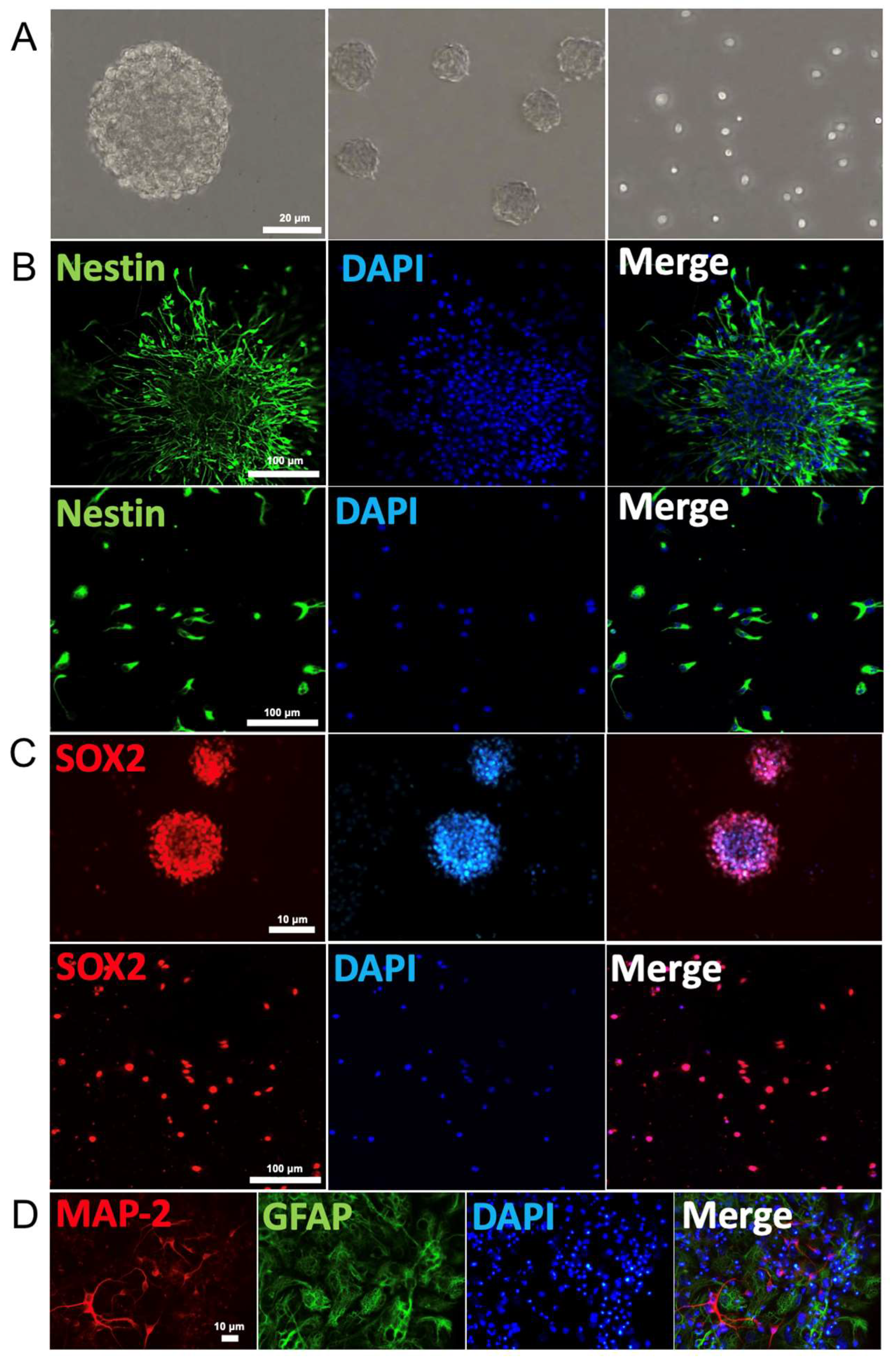 CIMB Free Full-Text Hypoxic Preconditioned Neural Stem Cell-Derived Extracellular Vesicles Contain Distinct Protein Cargo from Their Normal Counterparts picture