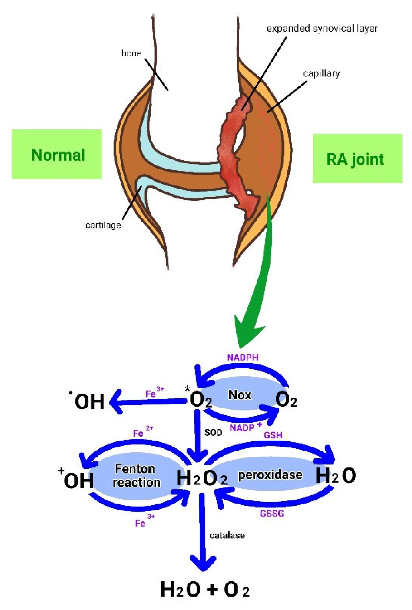 CIMB Free Full Text Rheumatoid Arthritis And Reactive Oxygen 