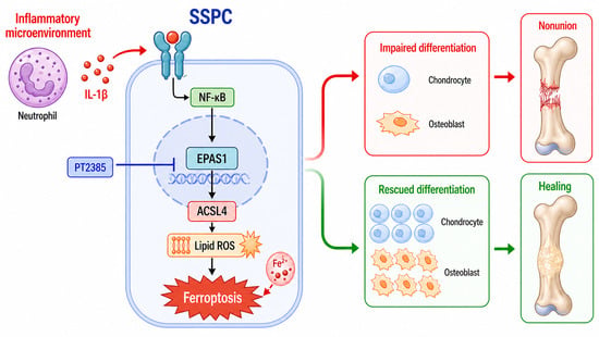 IL-1β/EPAS1-Associated Ferroptotic Stress Impairs Skeletal Stem/Progenitor Cell Function in Inflammation-Associated Fracture Nonunion