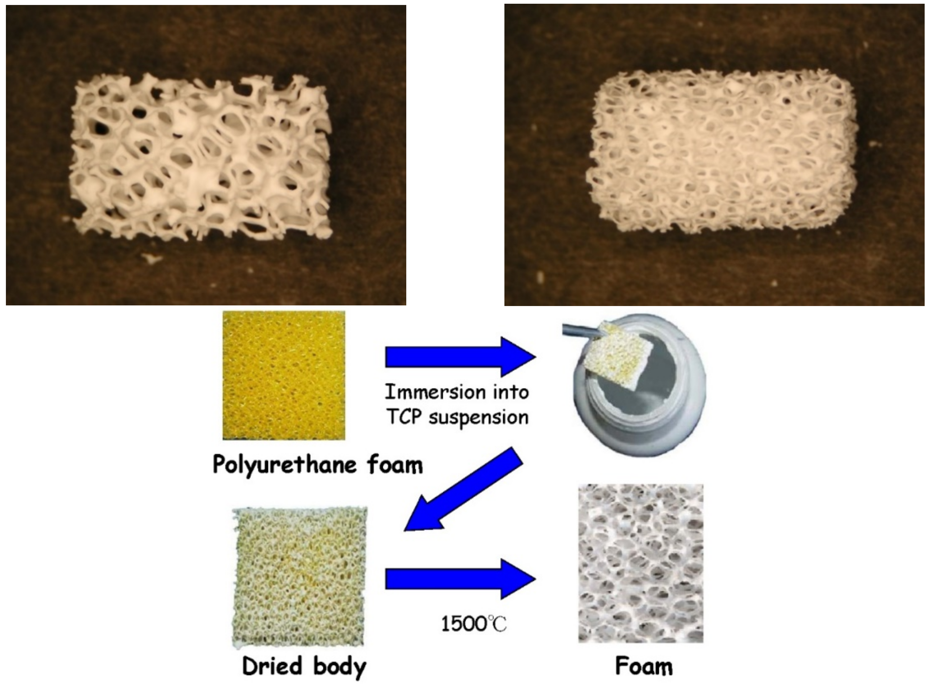 A block of synthetic micromacroporous biphasic calcium-phosphate (BCP)