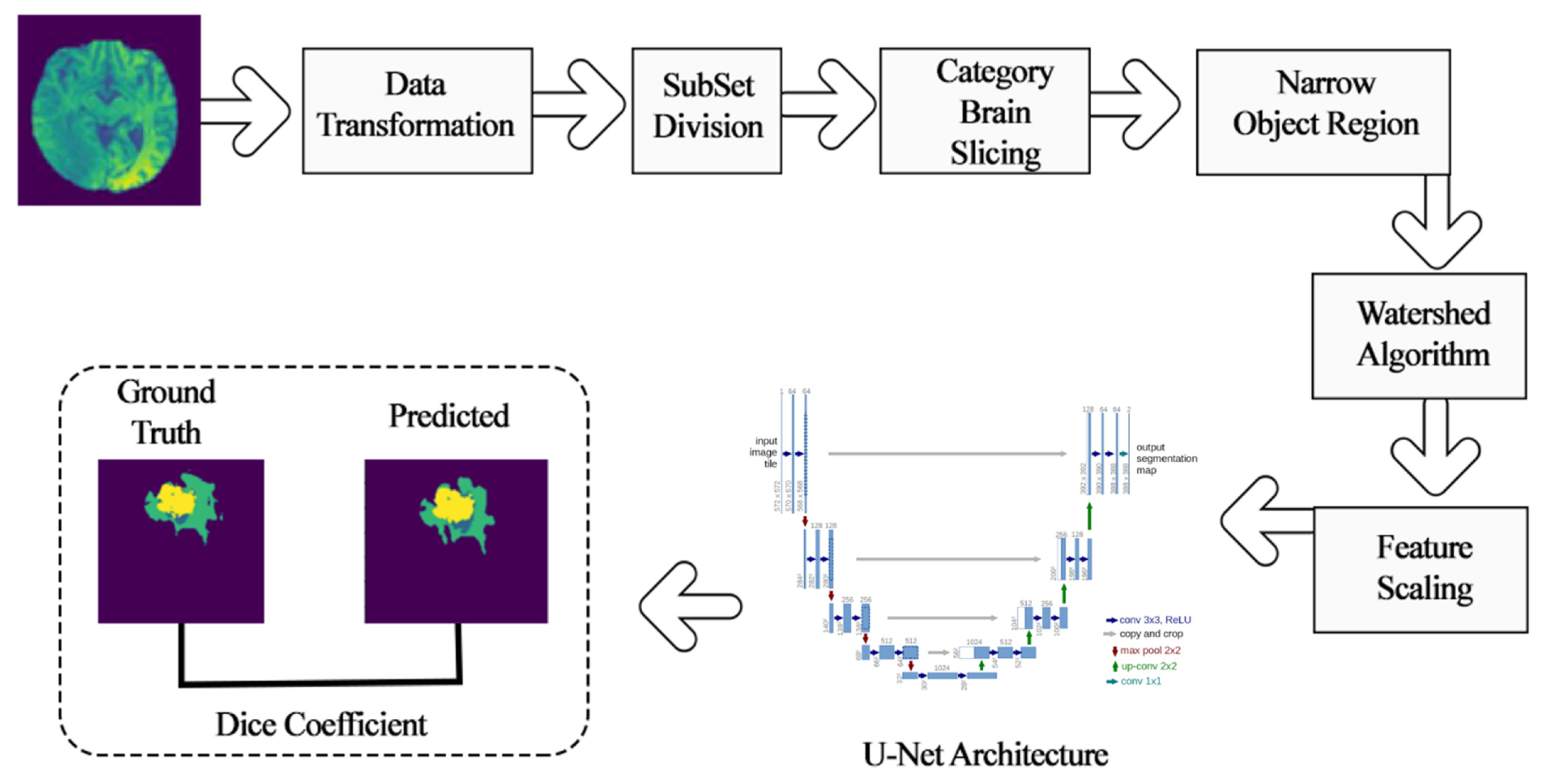 Automatic Brain Tumor Detection Using Convolutional Neural Networks