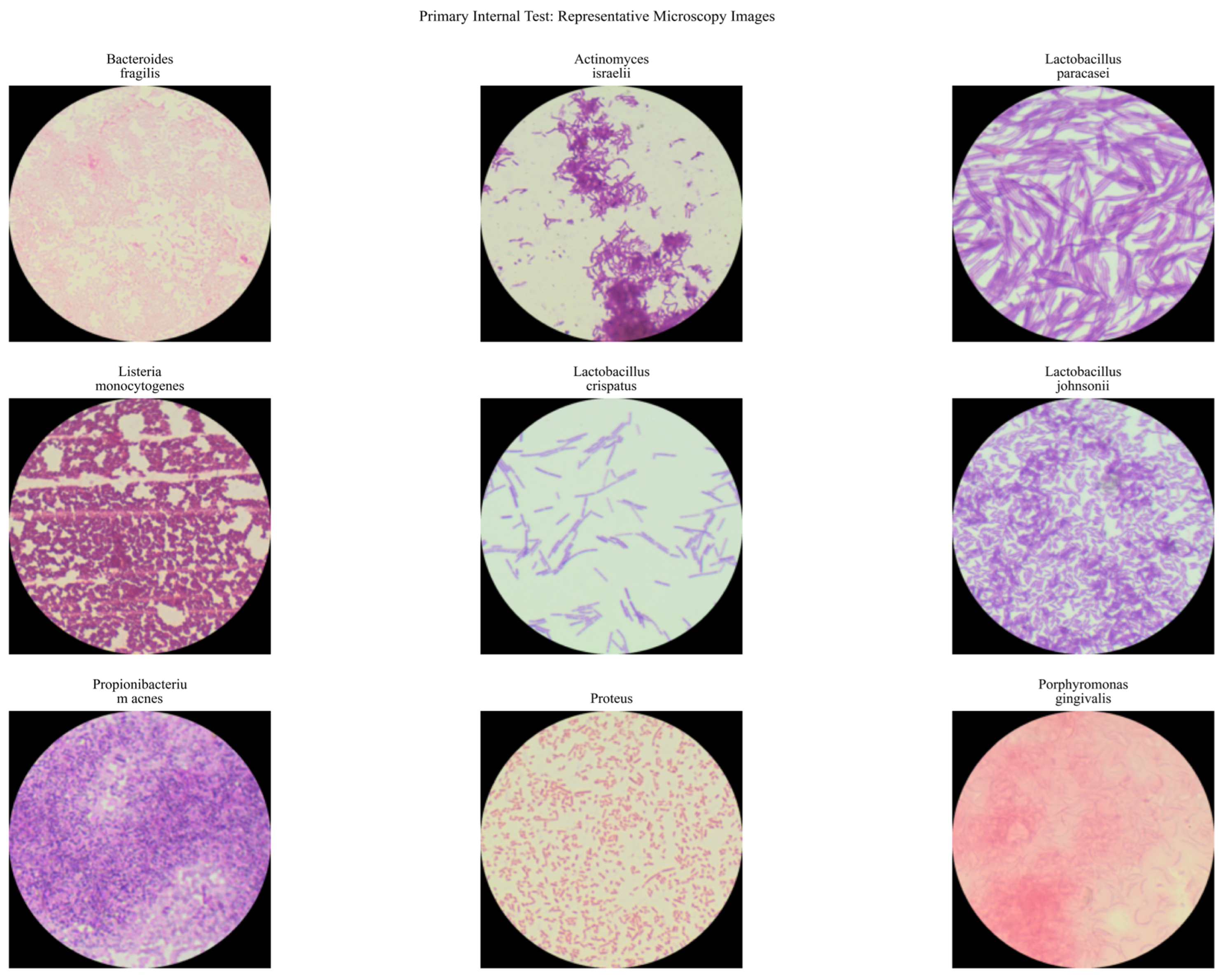 A Hybrid MIL Architecture for Multi-Class Classification of Bacterial ...