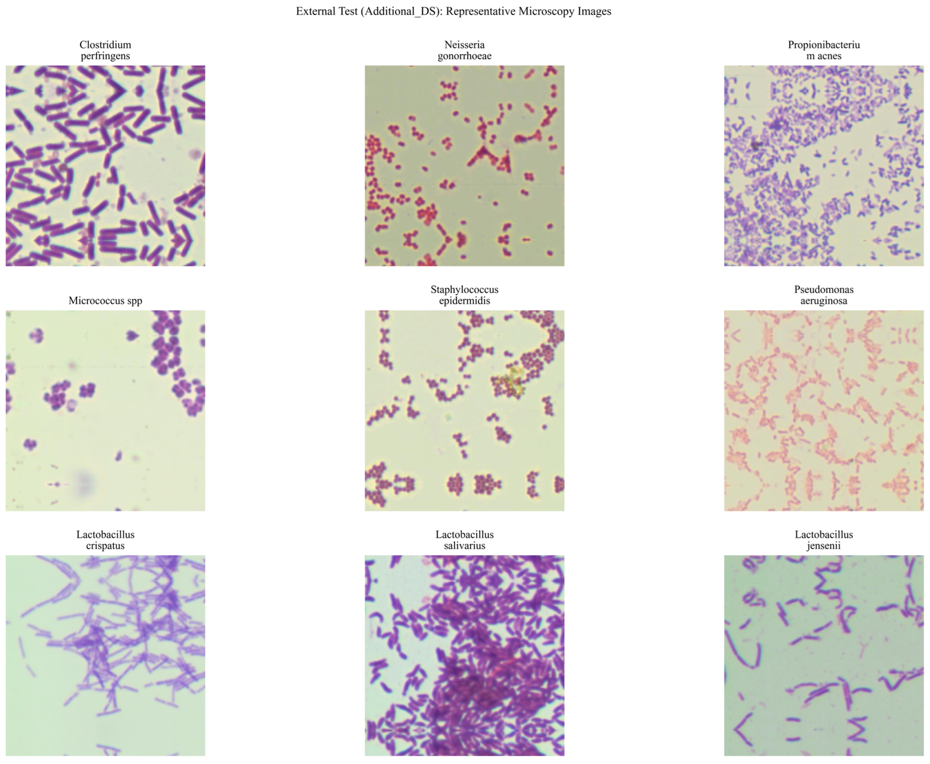 A Hybrid MIL Architecture for Multi-Class Classification of Bacterial ...
