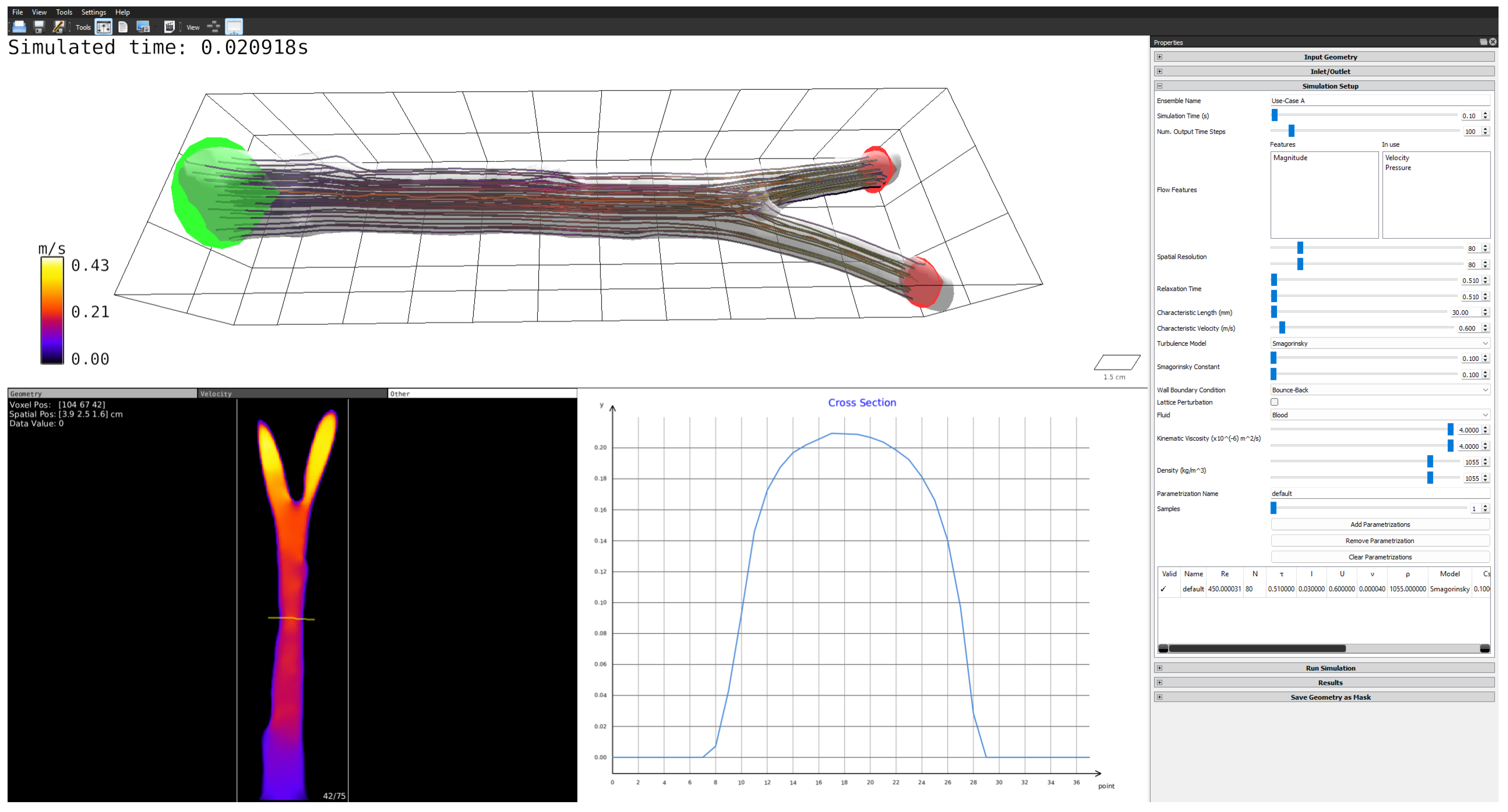 Blood Flow Simulated An Integrated Open-Source Software System for the Generation and ...
