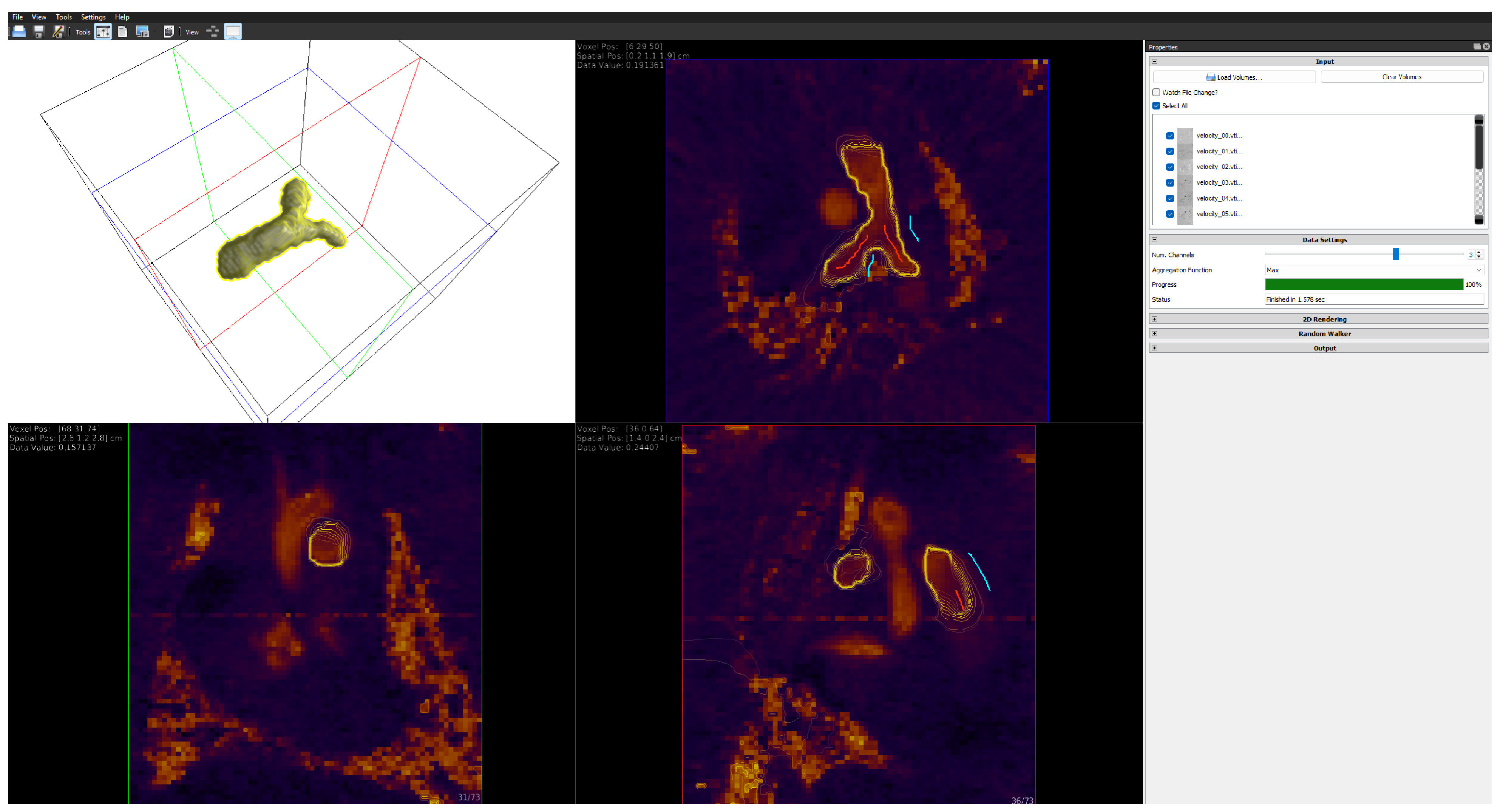 Blood Flow Simulated An Integrated Open-Source Software System for the Generation and ...