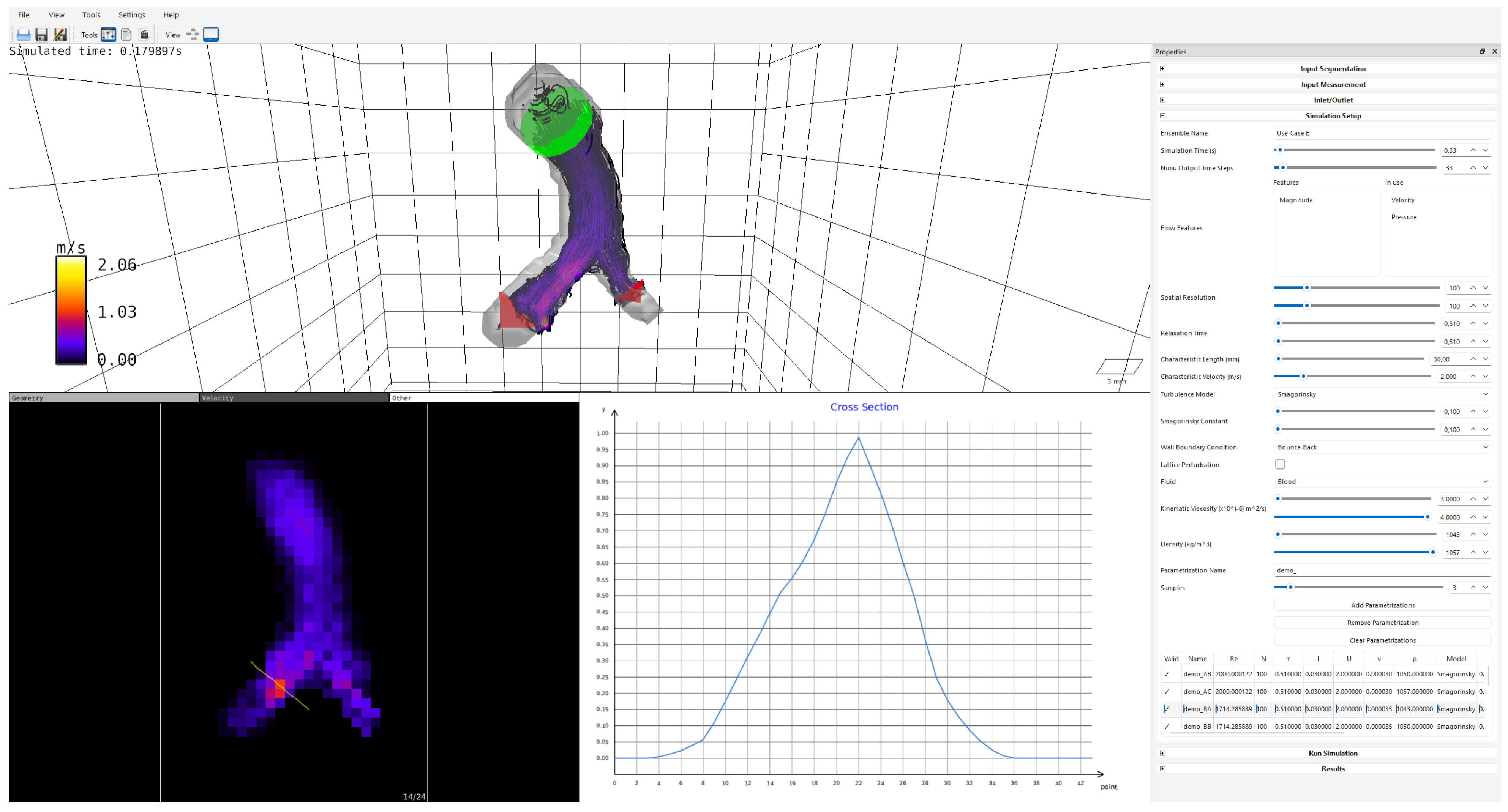 Blood Flow Simulated An Integrated Open-Source Software System for the Generation and ...