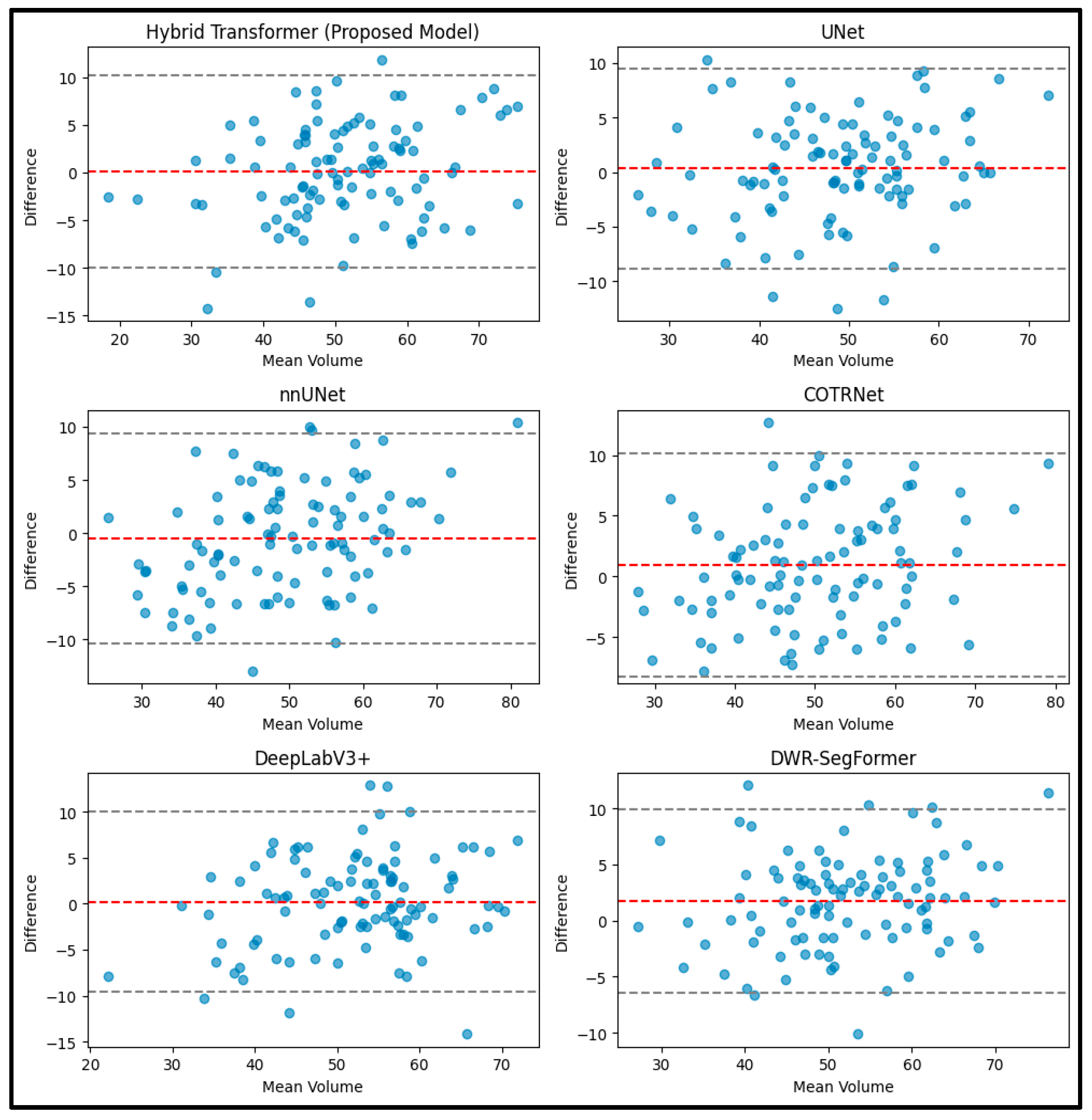 Hybrid Transformer Model with Augmentation for Kidney Tumor Segmentation