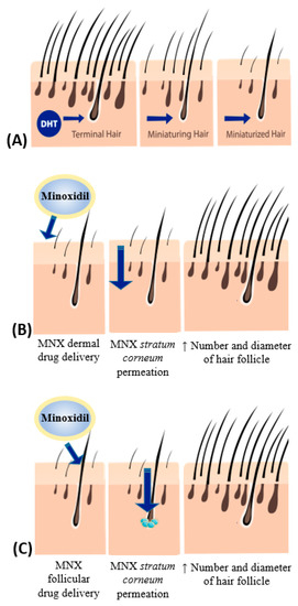Nanodrug Delivery Strategies to Signaling Pathways in Alopecia