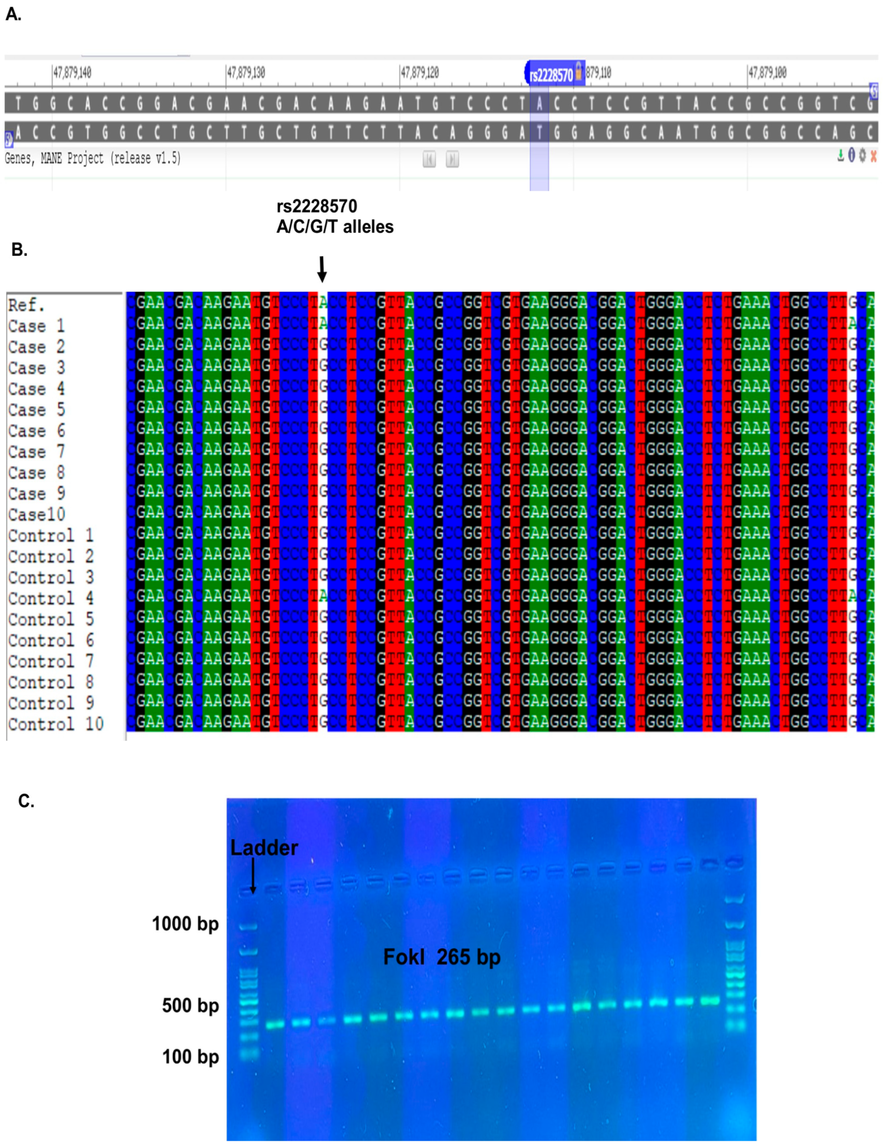 Association of Vitamin D Receptor (VDR) Gene Polymorphisms with COVID ...