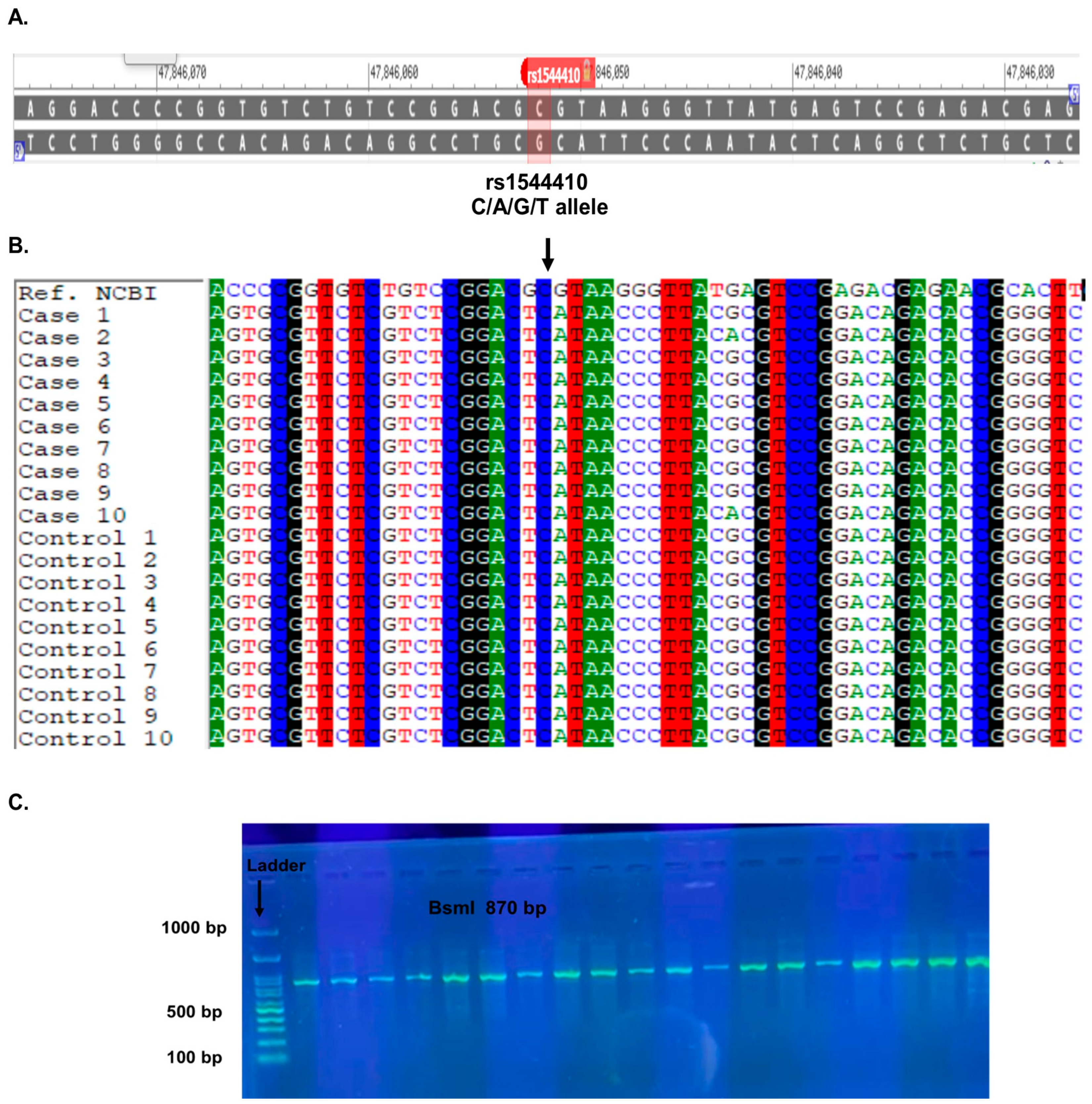 Association of Vitamin D Receptor (VDR) Gene Polymorphisms with COVID ...