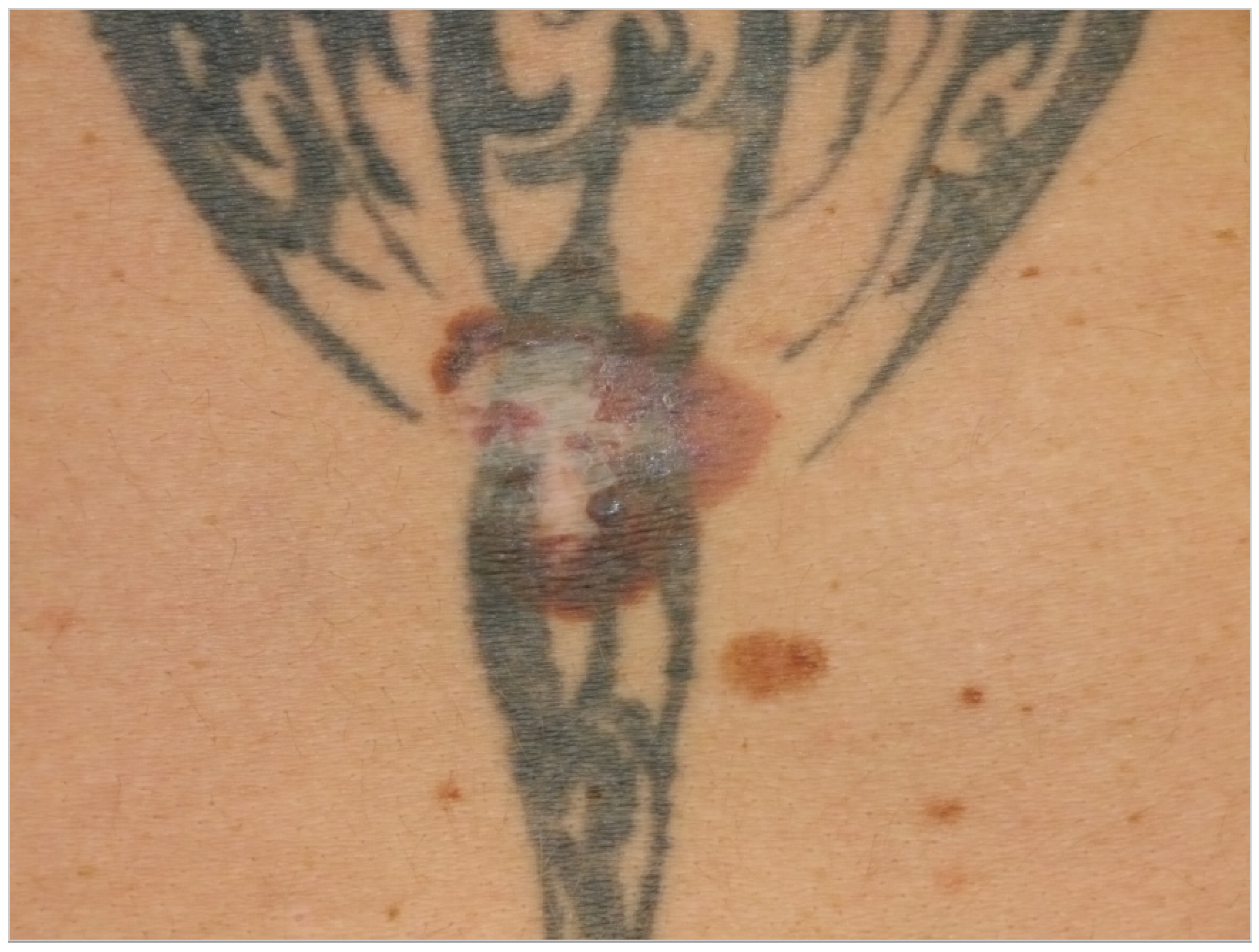 New Research Shows Some Tattoo Inks May Contain Potentially Dangerous  Ingredients