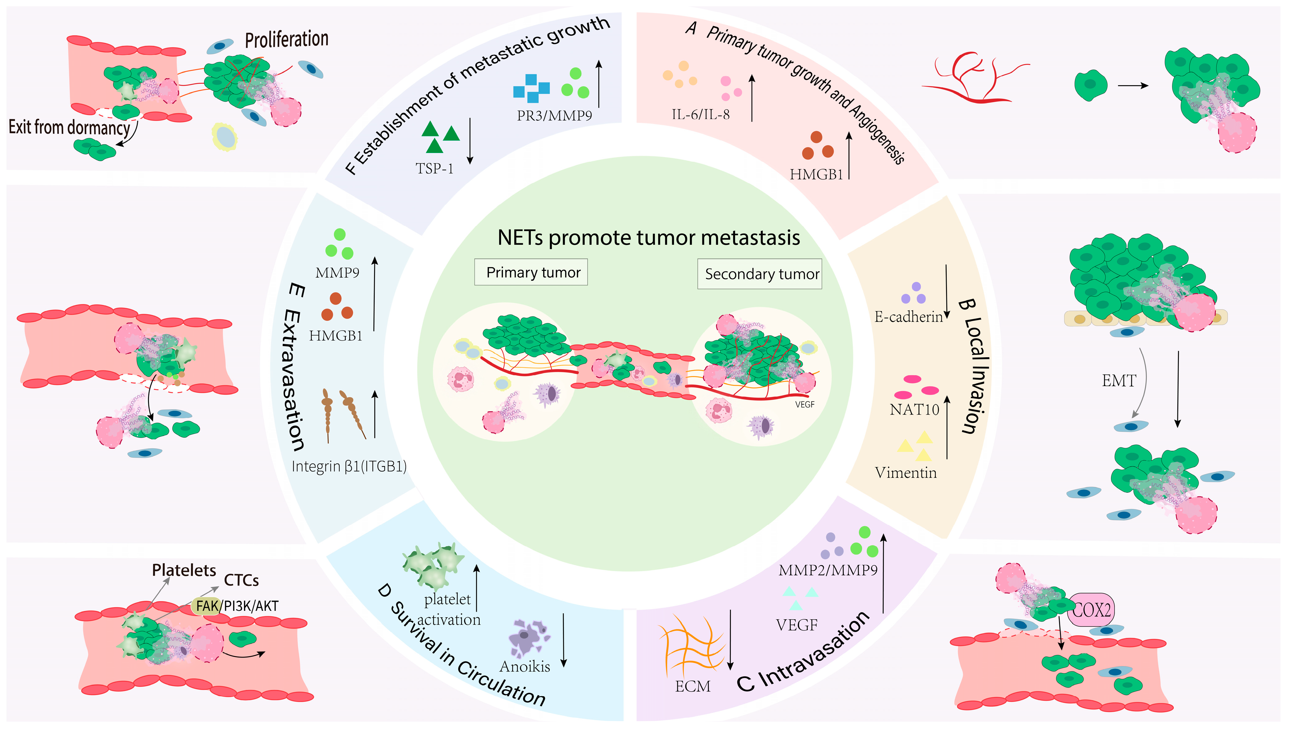 Neutrophil Extracellular Traps in Cancer Metastasis: From Mechanistic ...