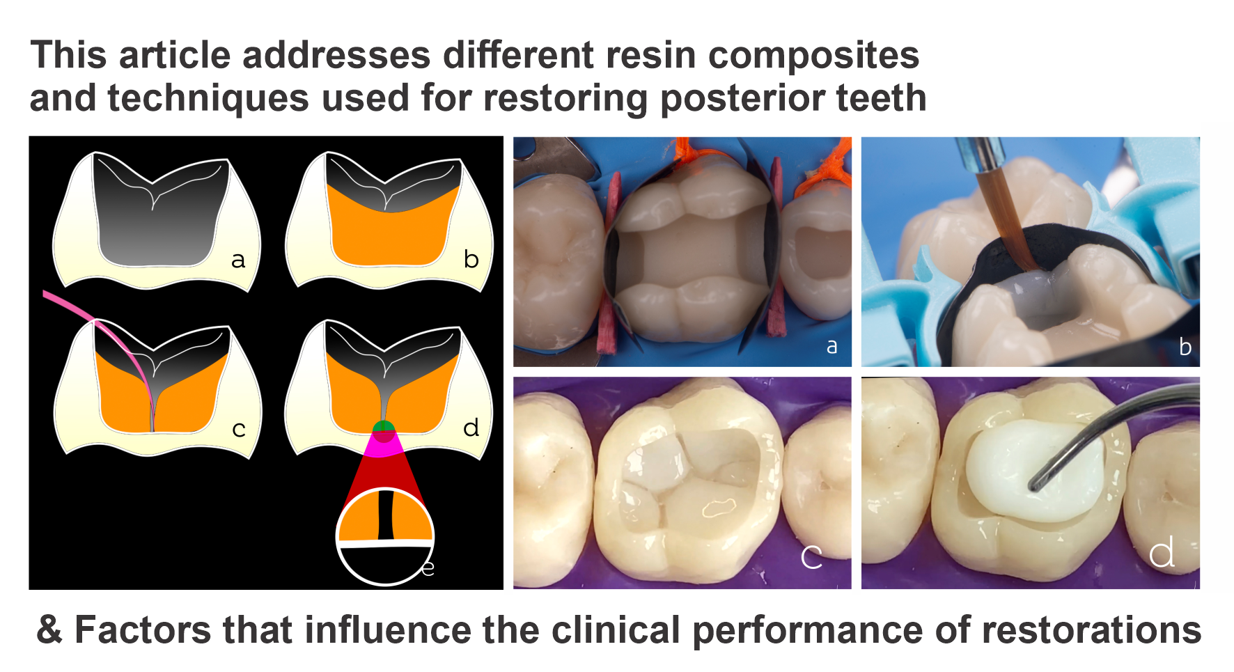Dental Nano Light Curing Composite Resin Filling Restorative