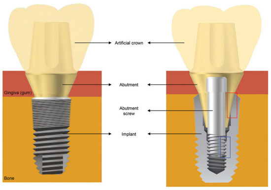 Dentistry Journal | Free Full-Text | Materials and Methods for All ...
