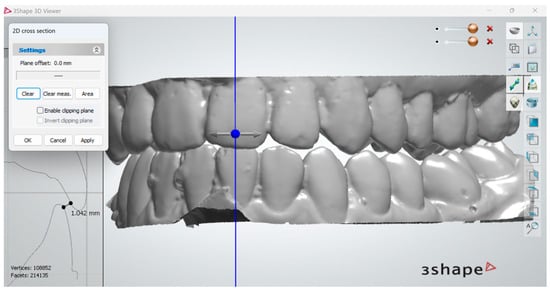 mdpi.com - Digital Analysis of Closest Speaking Space in Dentates-Method Proposal and Preliminary Findings