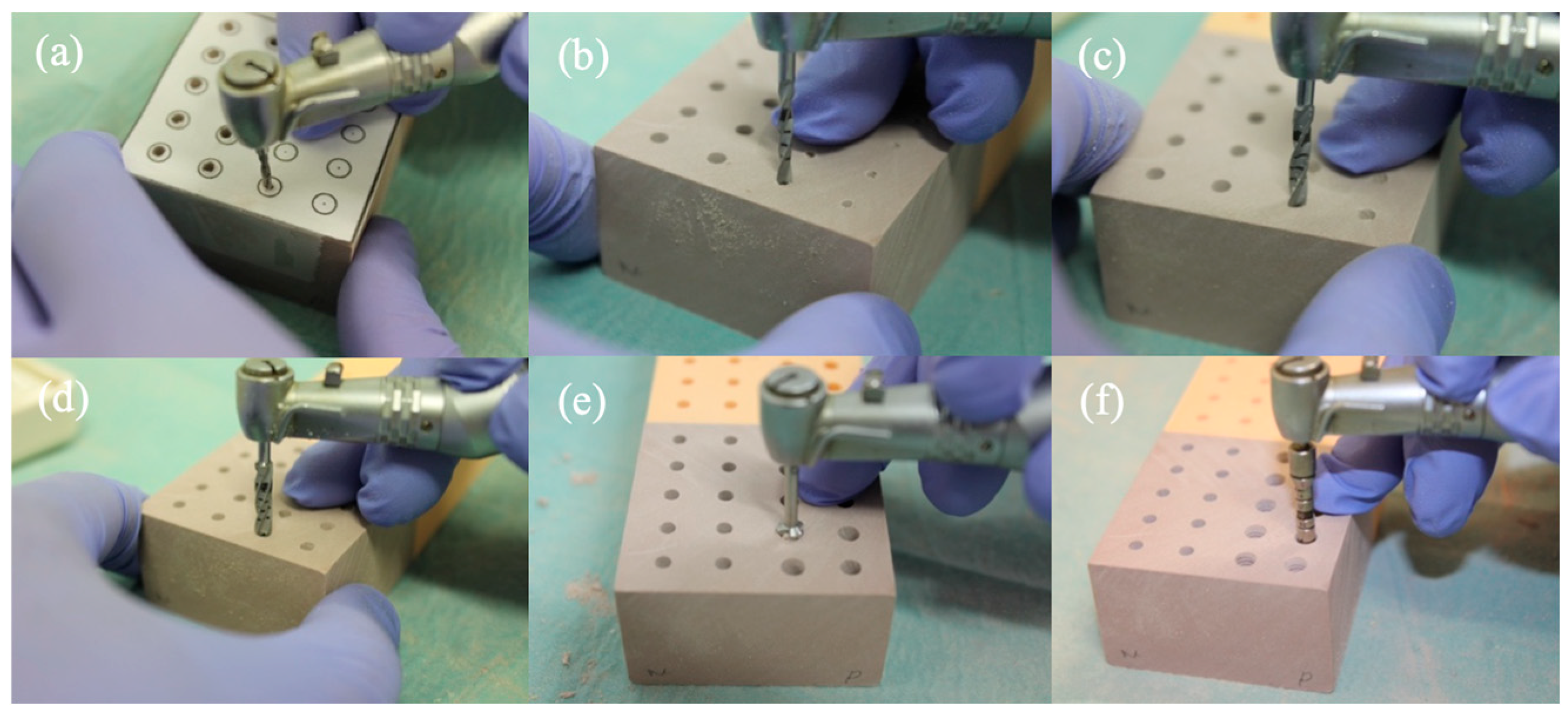 Primary Stability of Zirconia Dental Implants with Cylindrical and Tapered  Designs Across Varying Bone Densities: An In Vitro Evaluation