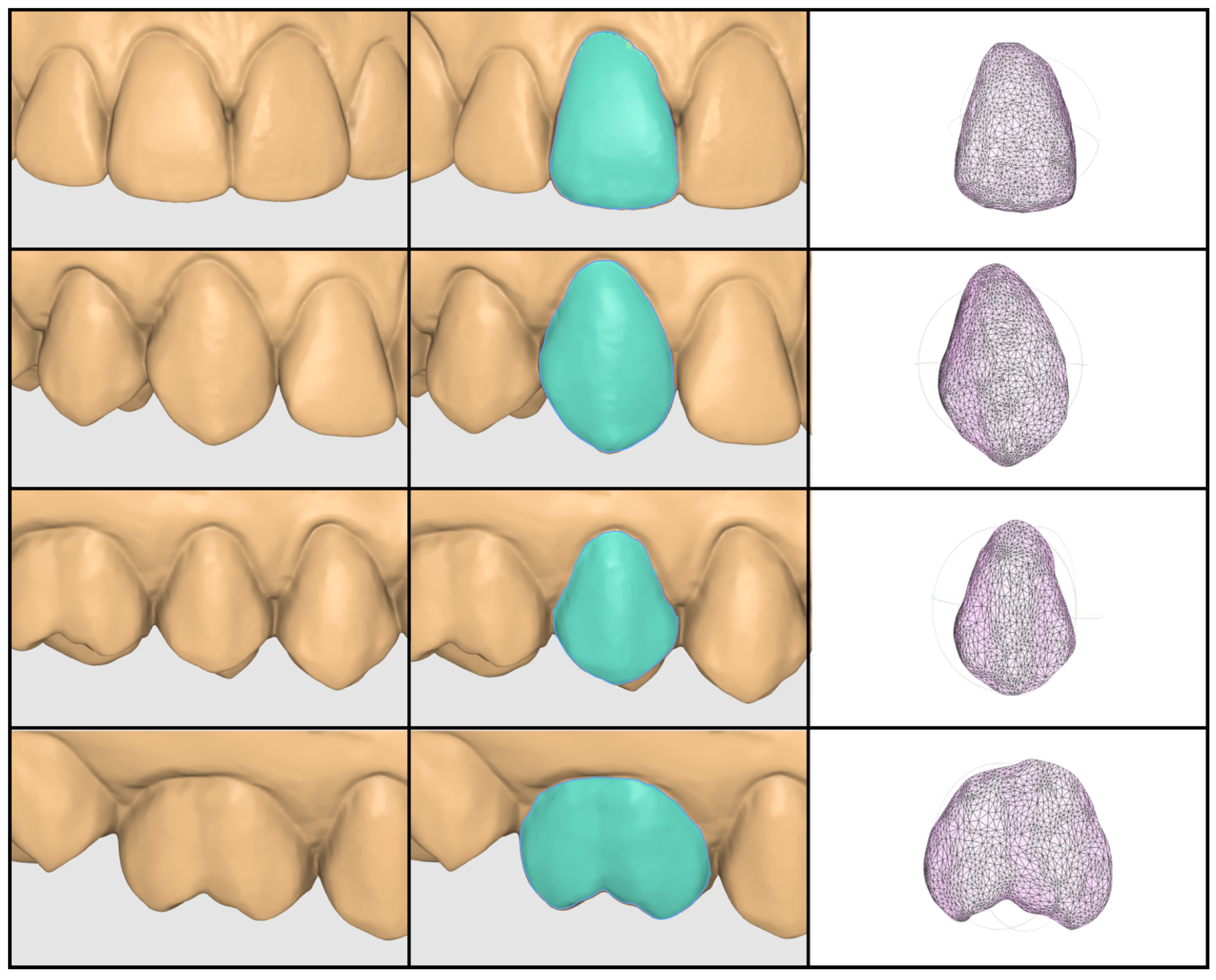 Influence of Tooth Morphology on Local Mesh Density Distribution in ...