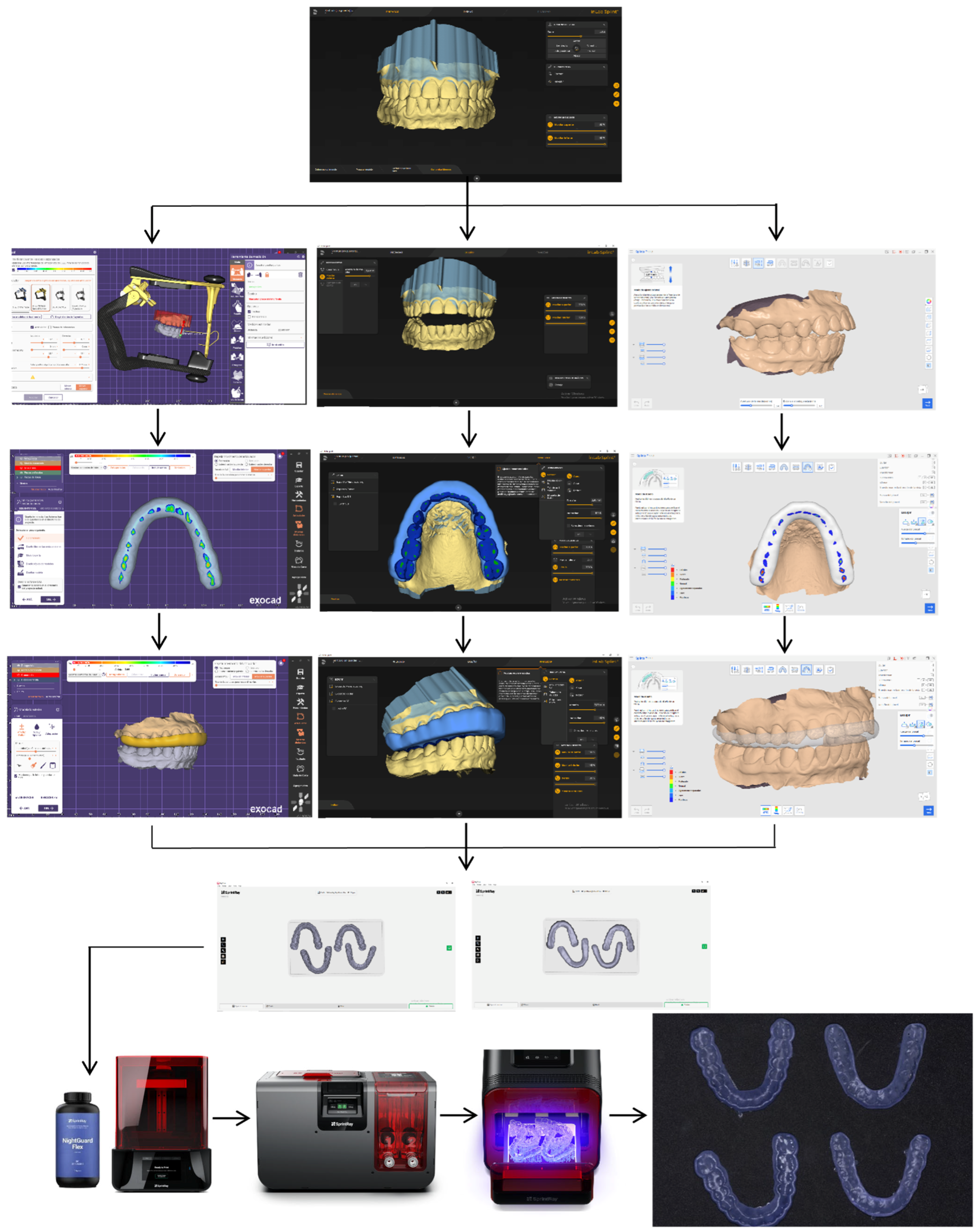 Accuracy and Reproducibility of Digital Vertical Dimension Increase in ...