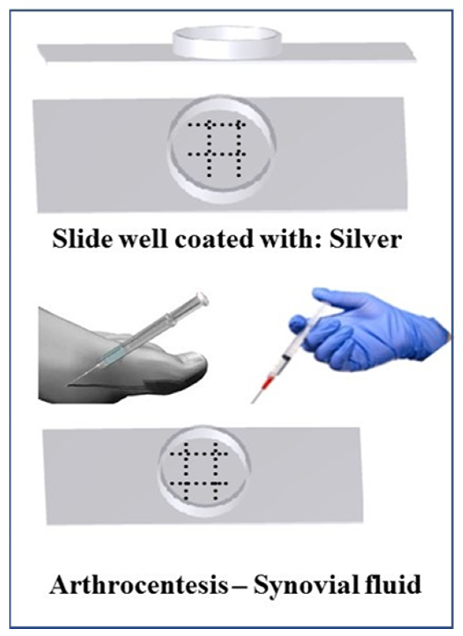 15 Minutes Rapid Detect Uric Acid Meter For Hospital Dry Chemistry Method