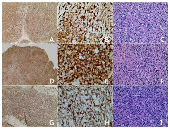 Immunohistochemical Features of Indoleamine 2,3-Dioxygenase (IDO) in ...