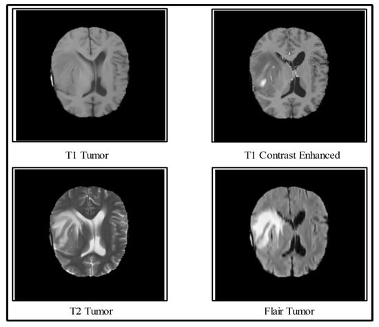 Diagnostics | Free Full-Text | Multimodal Brain Tumor Classification ...