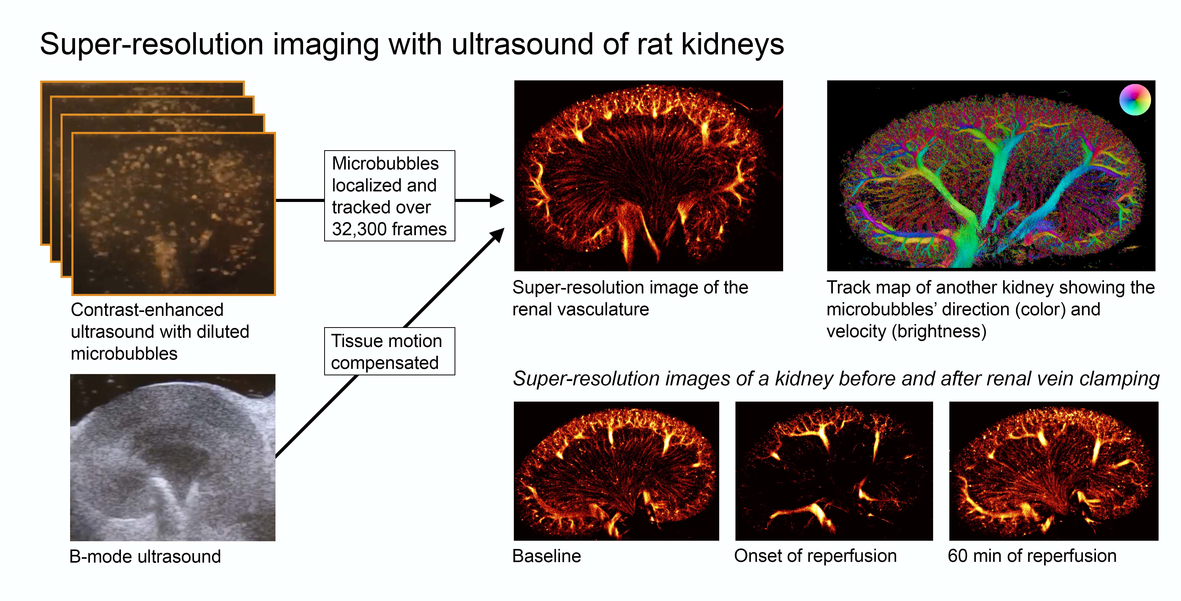 Diagnostics | Free | Super-Resolution Imaging with Ultrasound for Visualization the Renal Microvasculature in Before and After Renal Ischemia: A Study