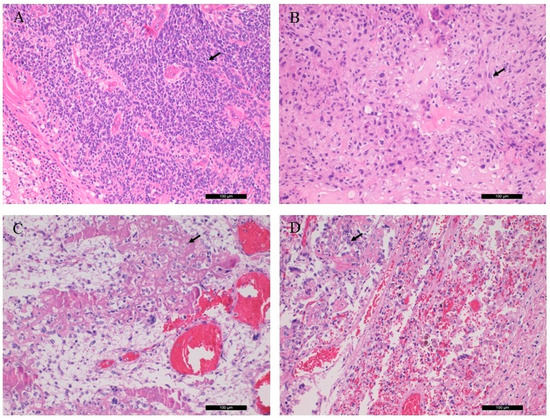 Diagnostics | Free Full-Text | Novel RB1 and MET Gene Mutations in a ...