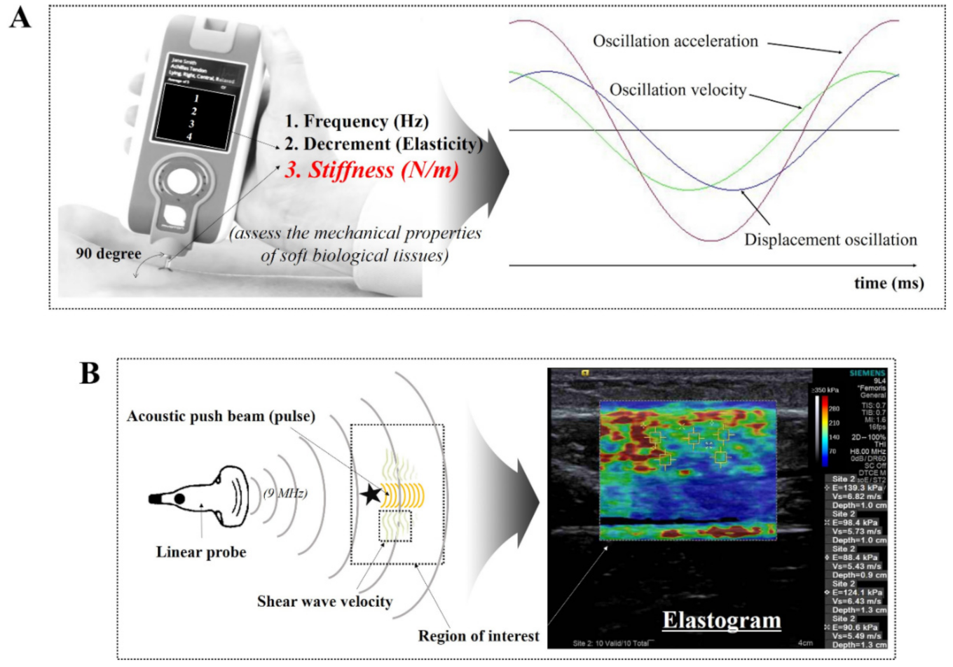 Diagnostics Free Full-Text The Measurement of Stiffness for Major Muscles with Shear Wave Elastography and Myoton A Quantitative Analysis Study