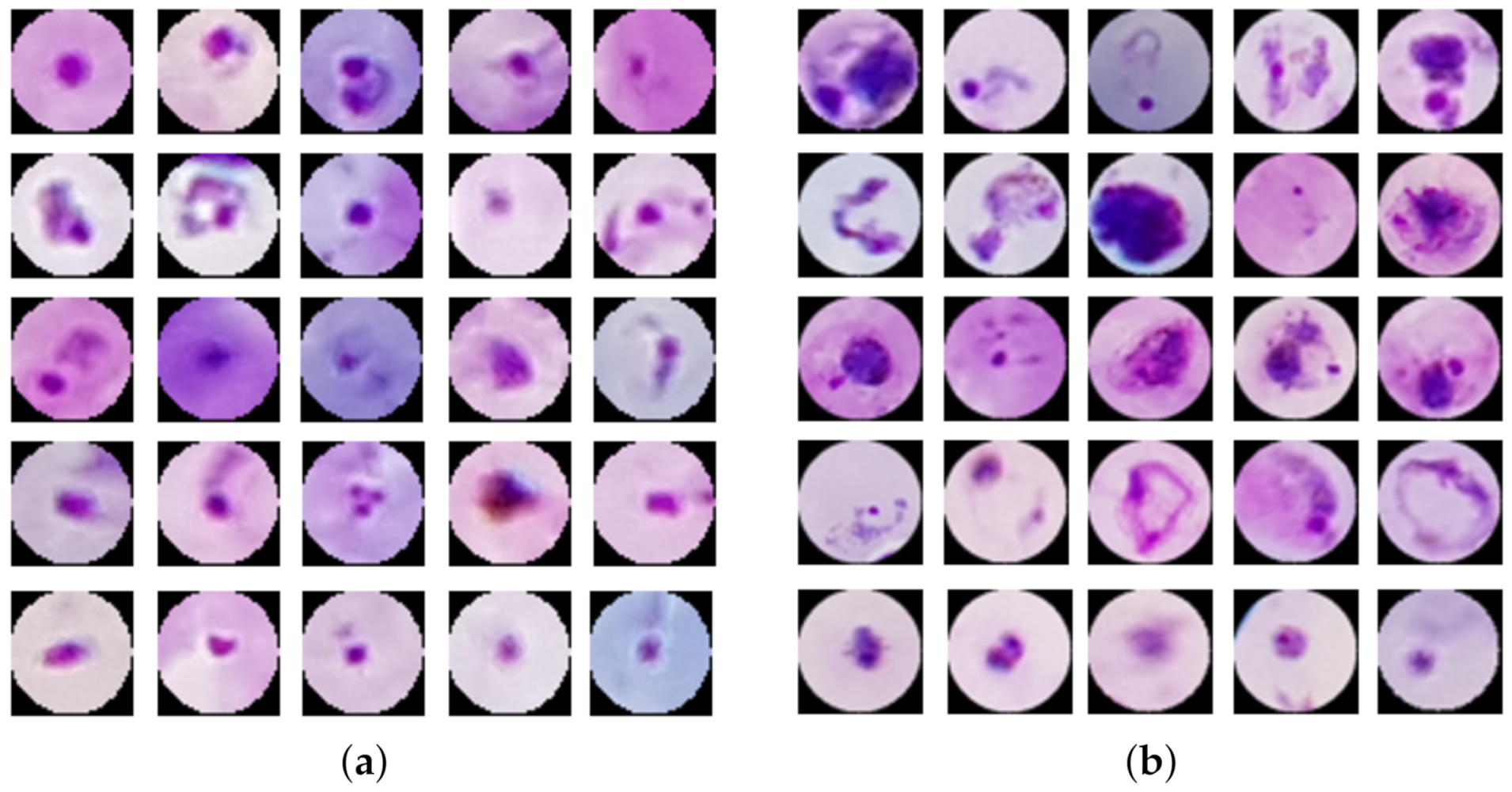 Diagnosing Malaria Patients With Plasmodium Falciparum And Vivax Using Diagnosing Malaria Patients With Plasmodium Falciparum And Vivax Using