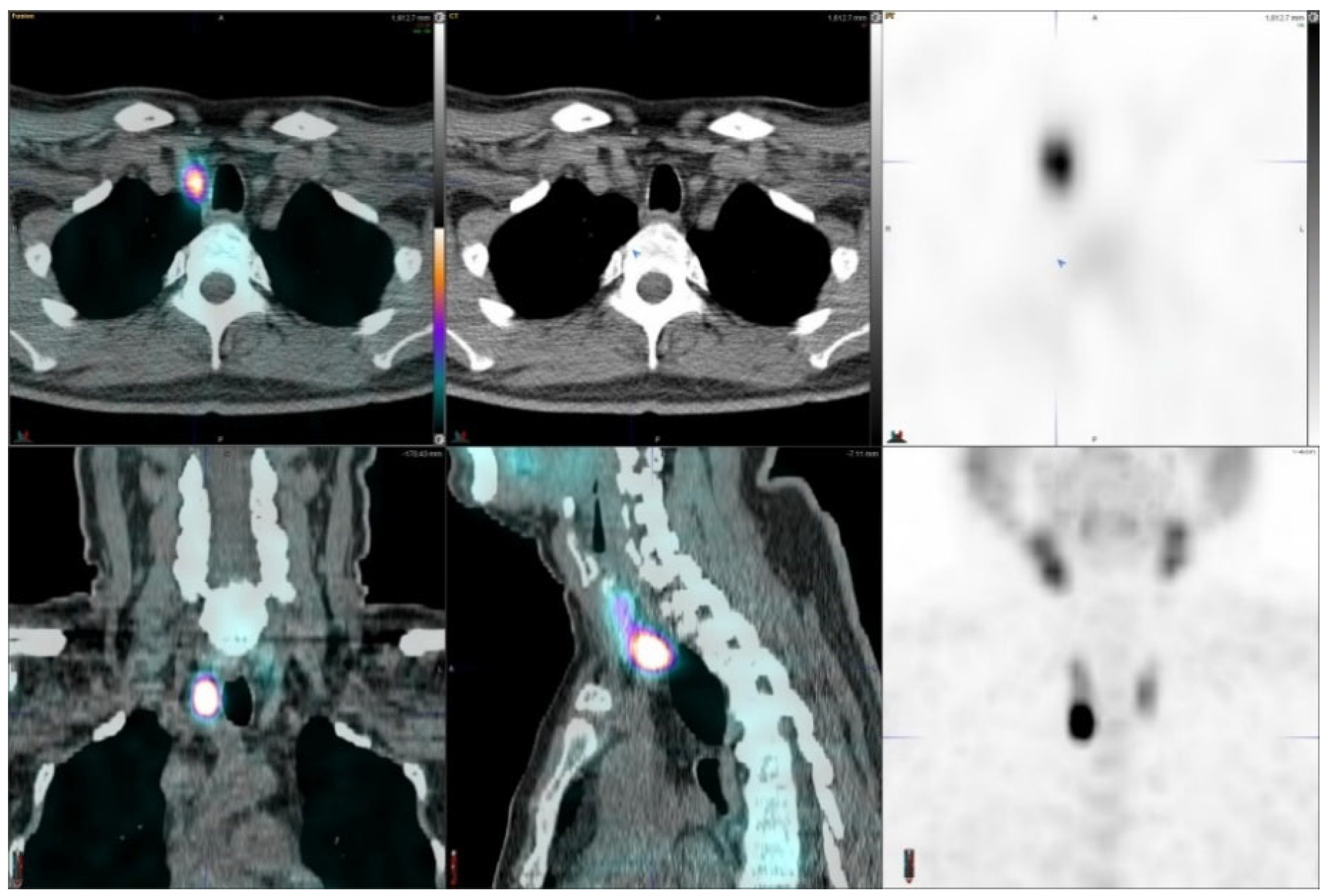 Diagnostics | Free Full-Text | A Prospective Comparative Study Of Using ...