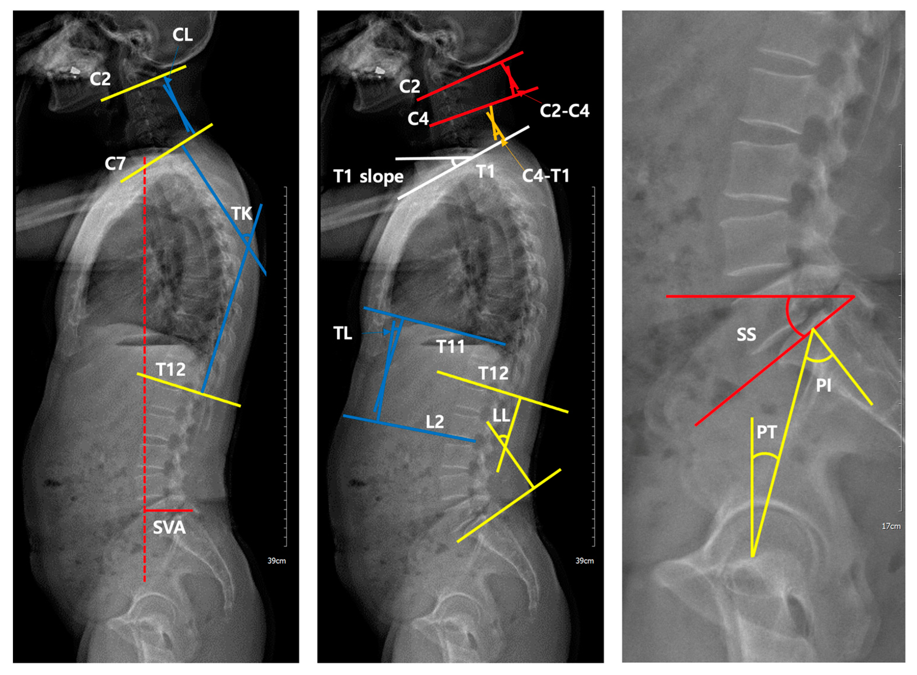 Anatomic Variation and Asymmetry in Female Anterior Thoracic Contour: A  Review of 50 Consecutive CT Scans