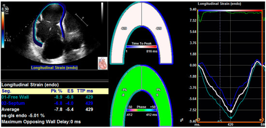 Role of strain echocardiography in patients with hypertension