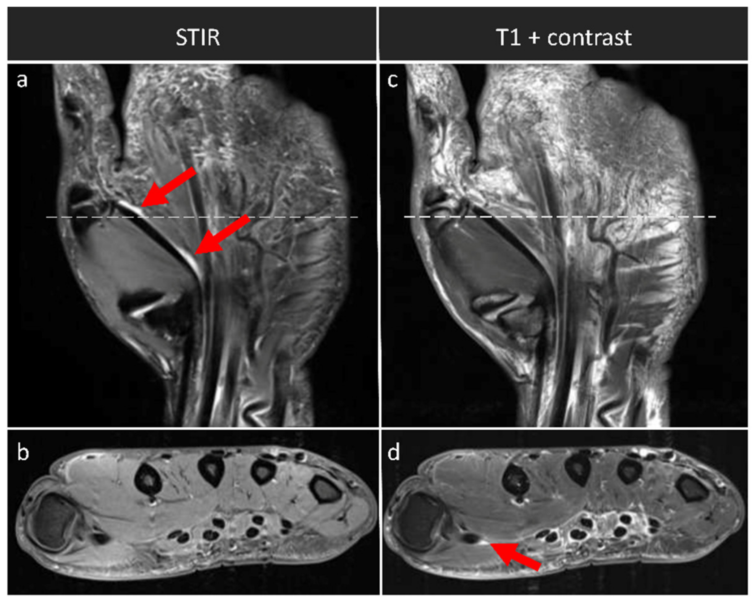 Diagnostics Free Full Text To Contrast Or Not To Contrast On The 