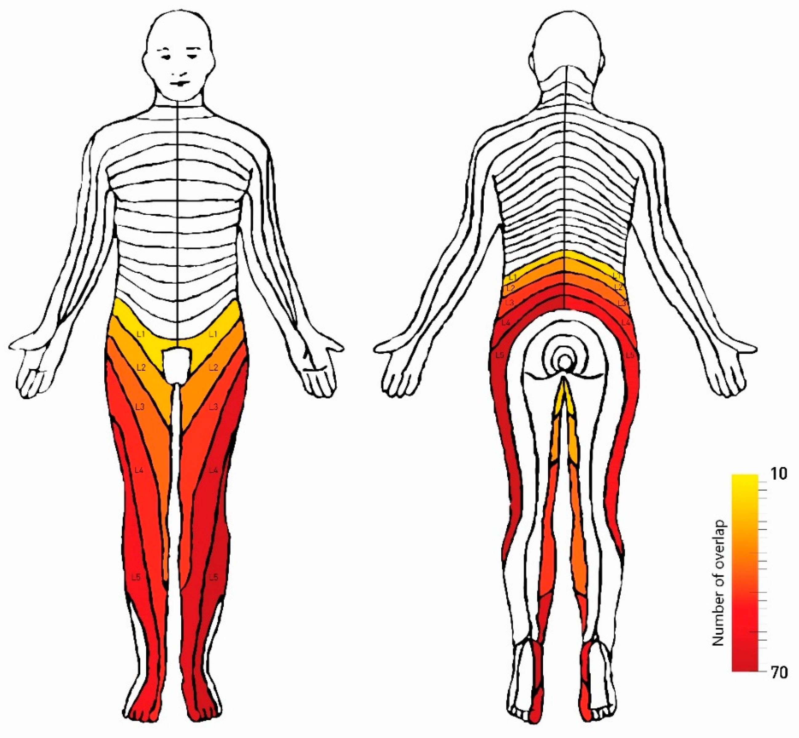 L3 Nerve Root Dermatome The Cauda Equina Syndrome Dermatomes HMFKKN L3 Nerve Root Dermatome The Cauda Equina Syndrome Dermatomes HMFKKN