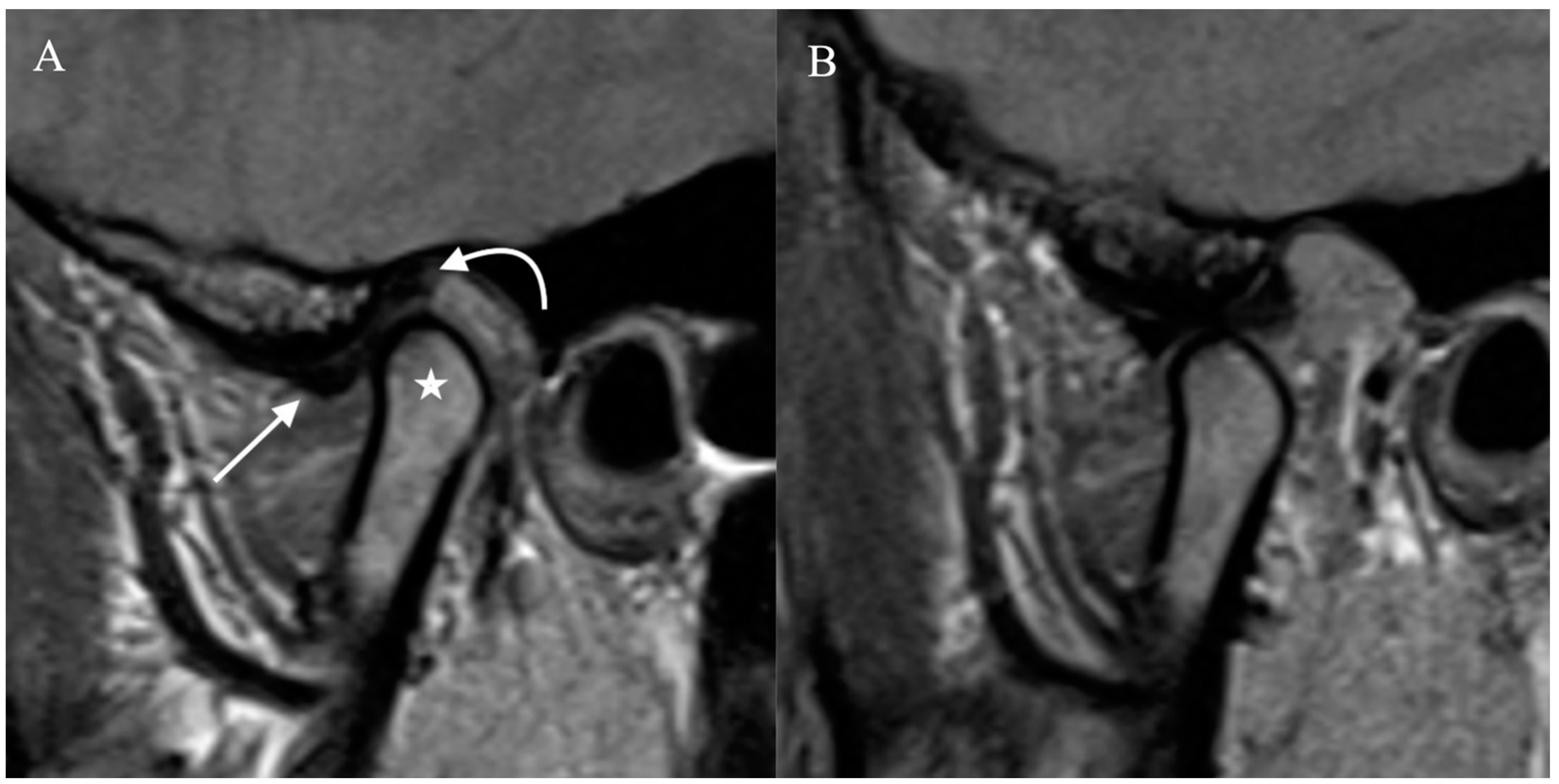 Diagnostics | Free Full-Text | Imaging of the Temporomandibular Joint