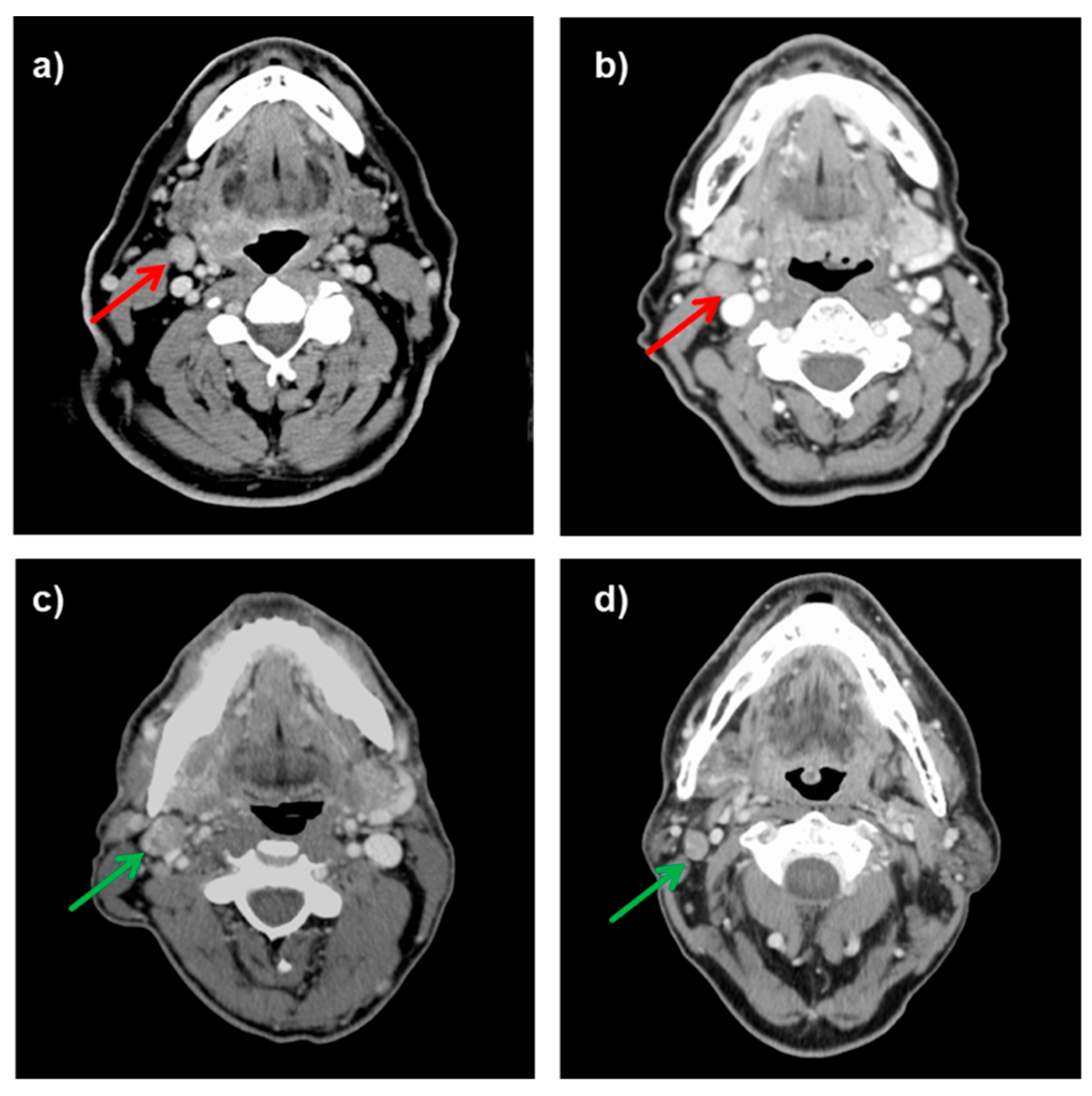 Diagnostics Free Full Text Frequency And Consequences Of Cervical 