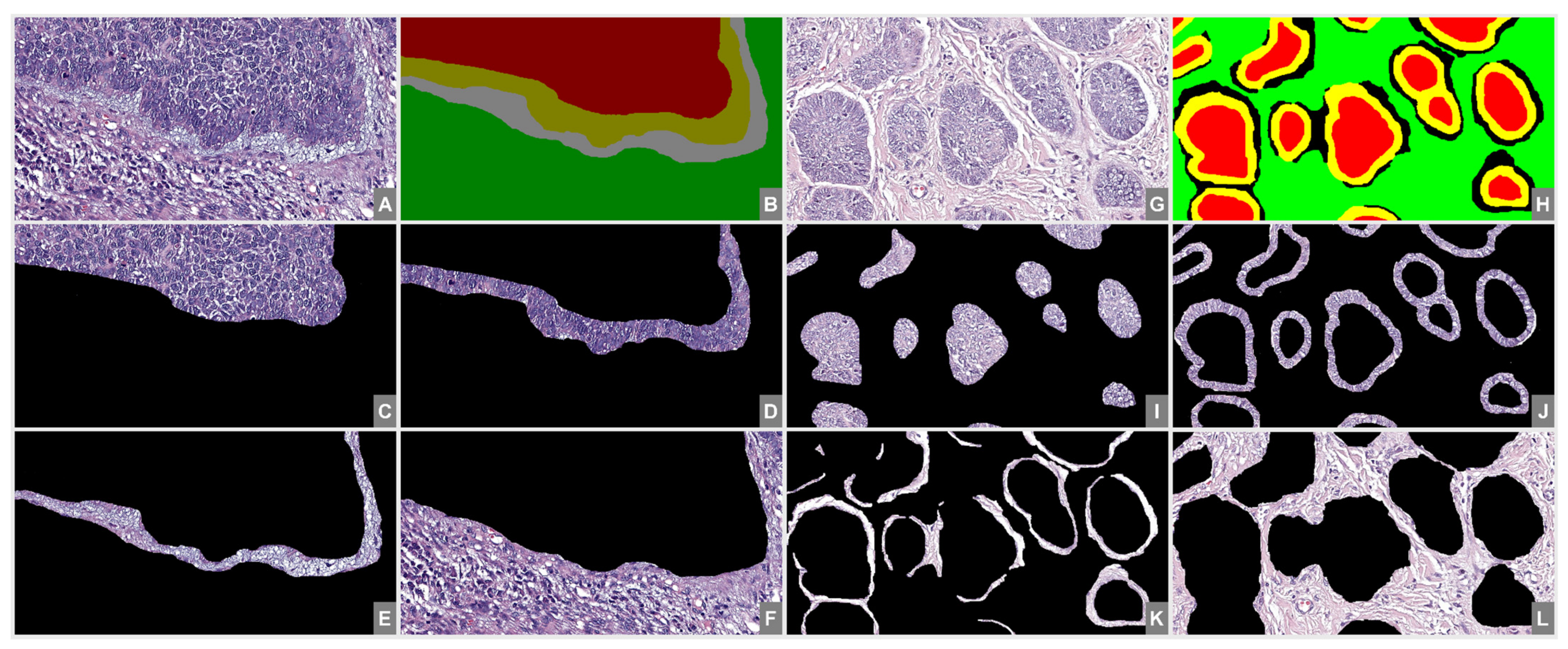 File:Normal breast histology.png - Wikipedia