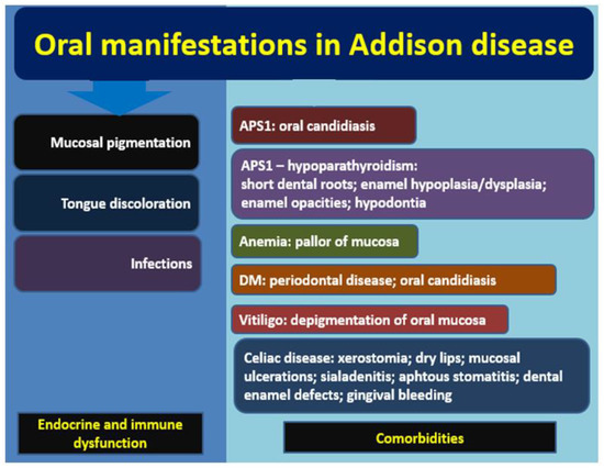 addison disease histology